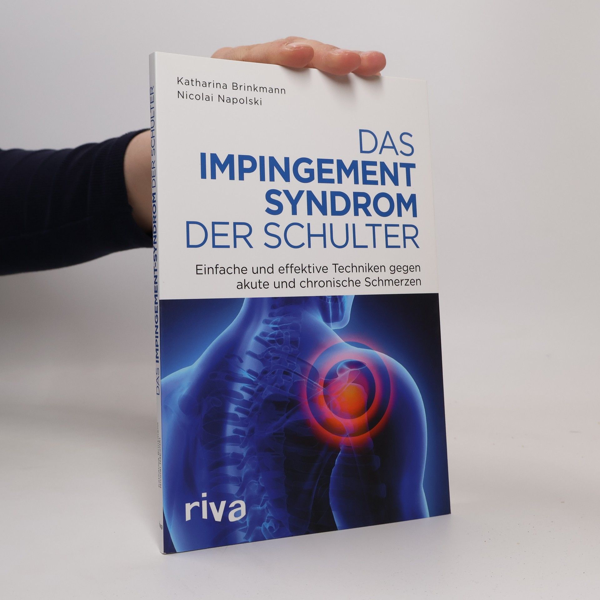 Das Impingement-Syndrom der Schulter