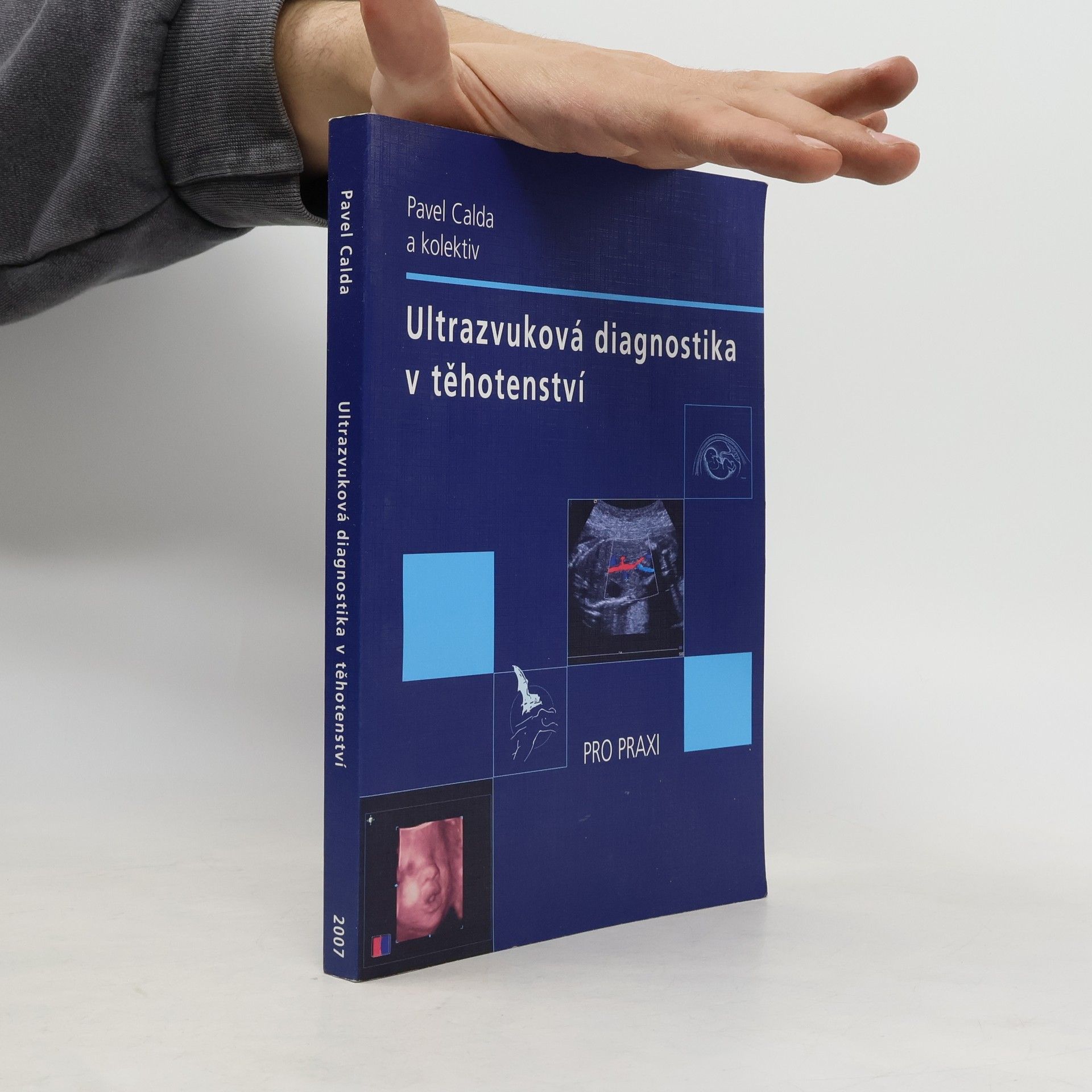 Pavel Calda Ultrazvuková diagnostika v těhotenství