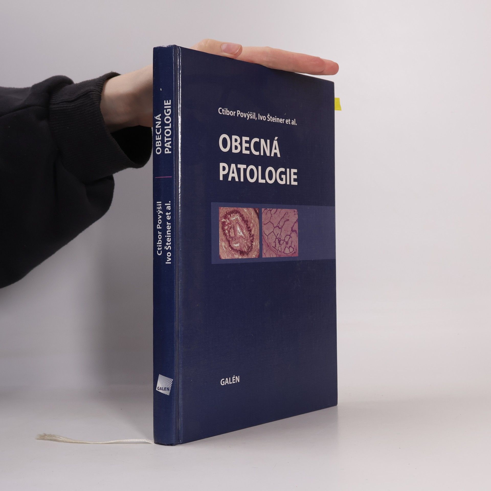 Ivo Šteiner Obecná patologie