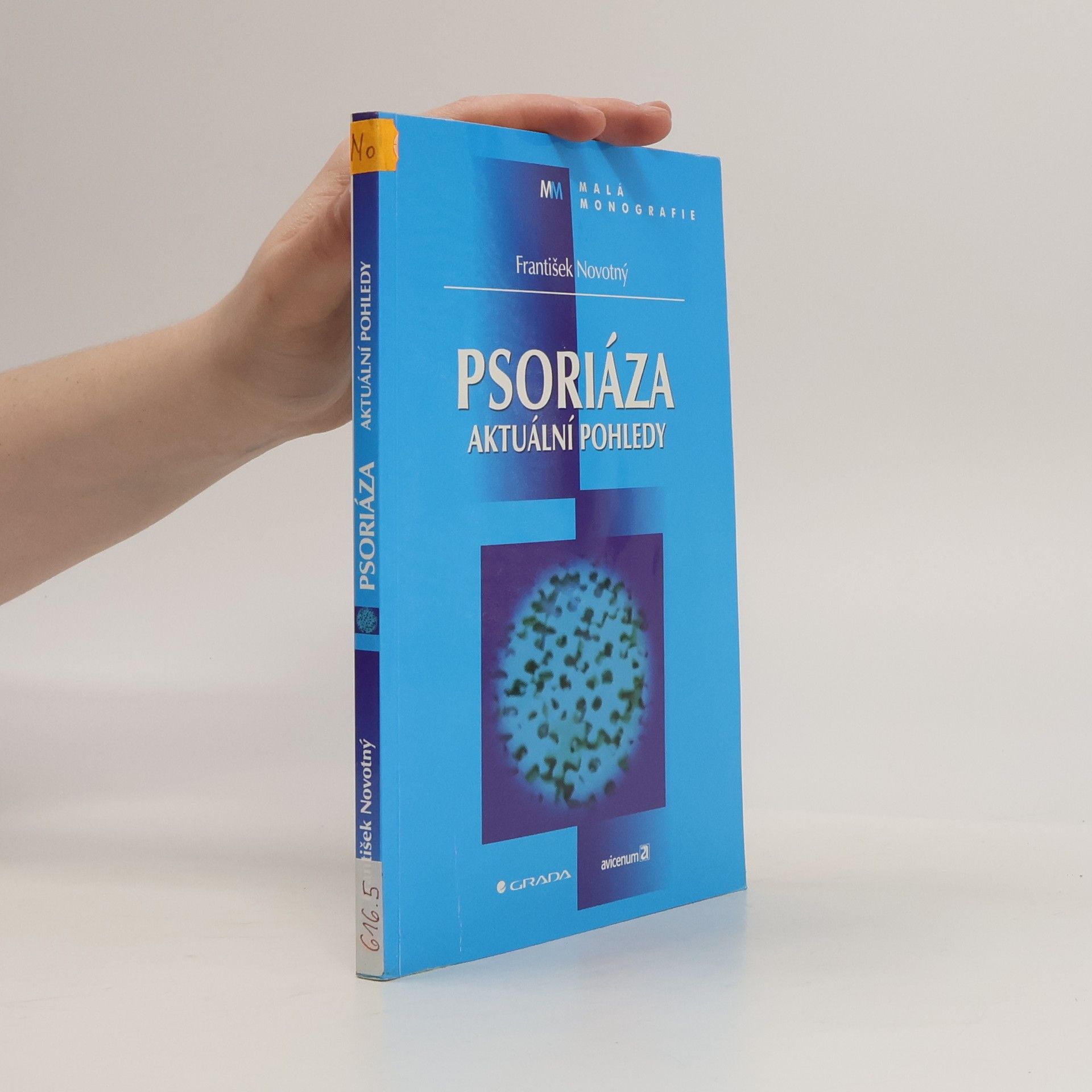 Psoriáza