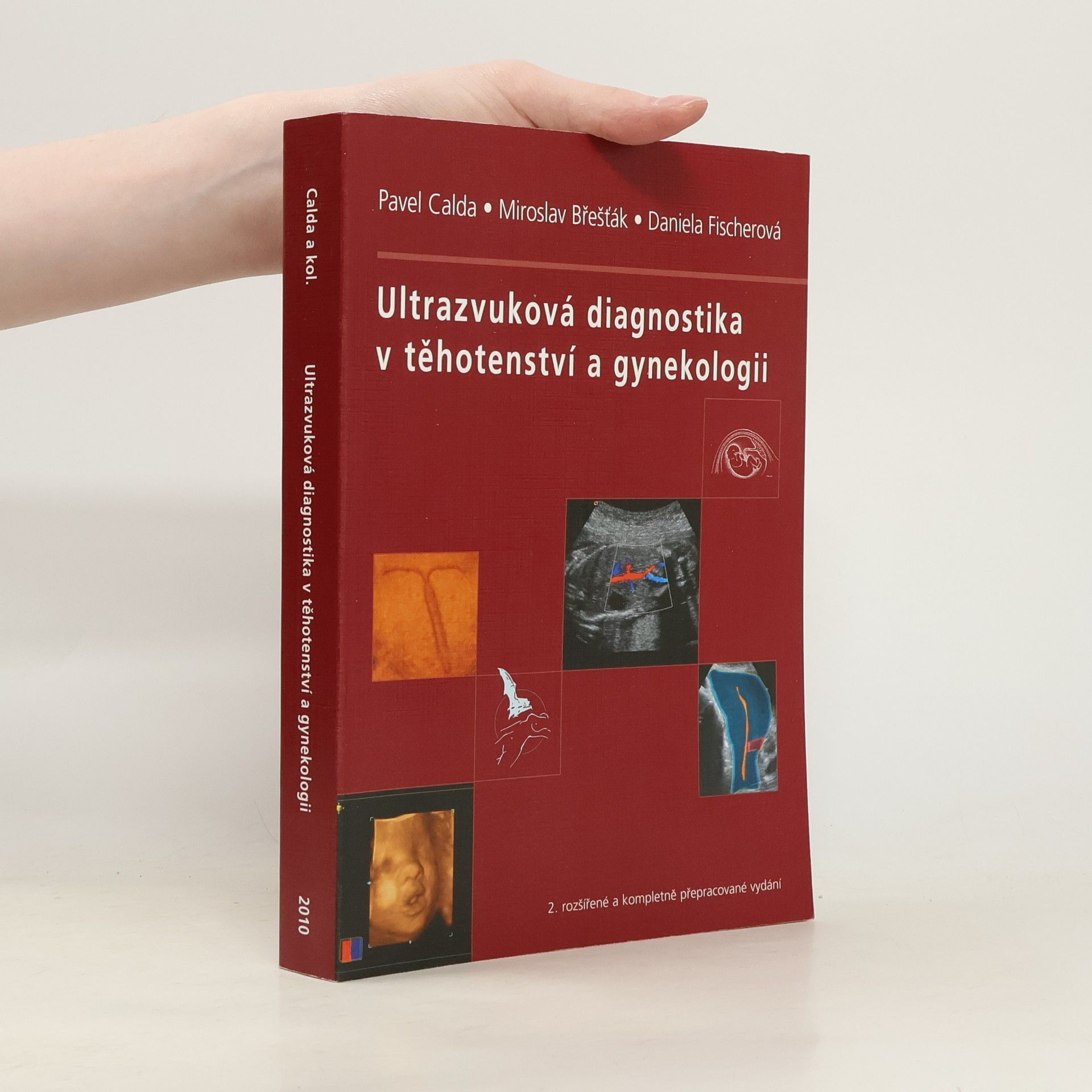 Pavel Calda Ultrazvuková diagnostika v těhotenství a gynekologii