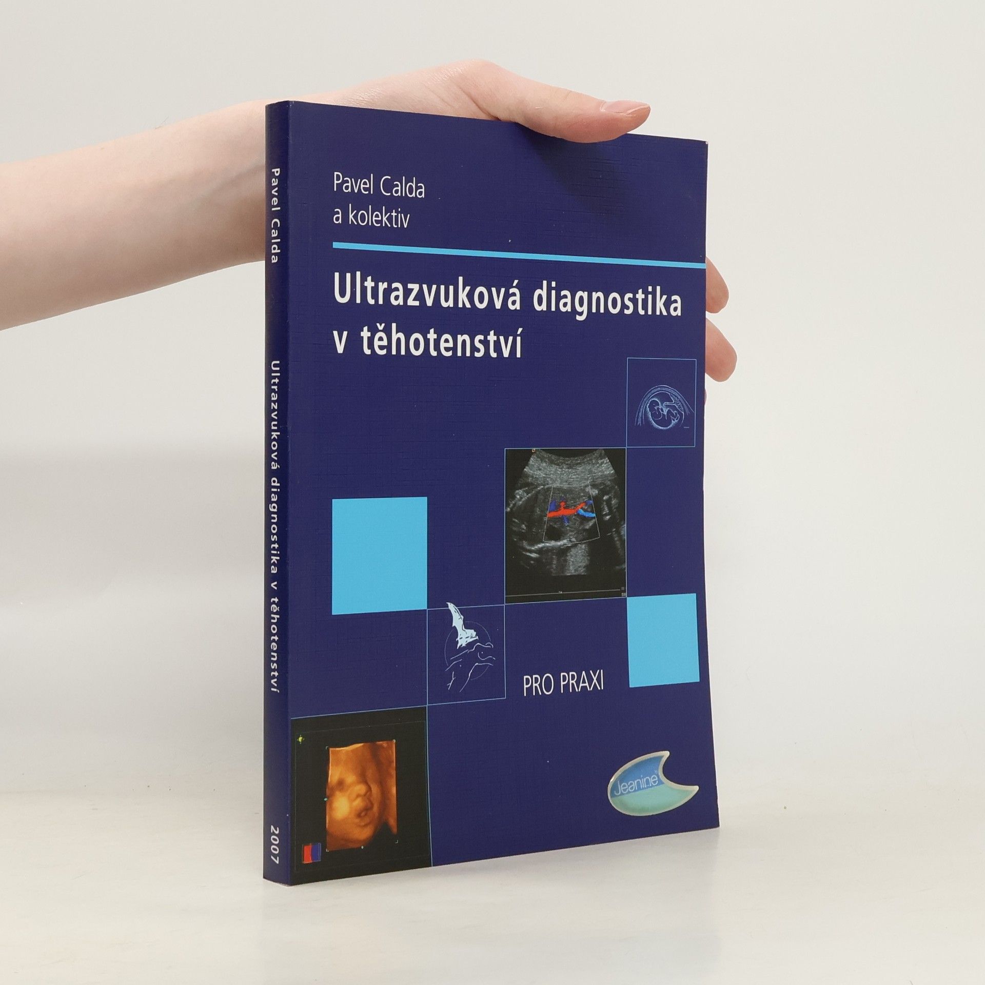 Ultrazvuková diagnostika v těhotenství