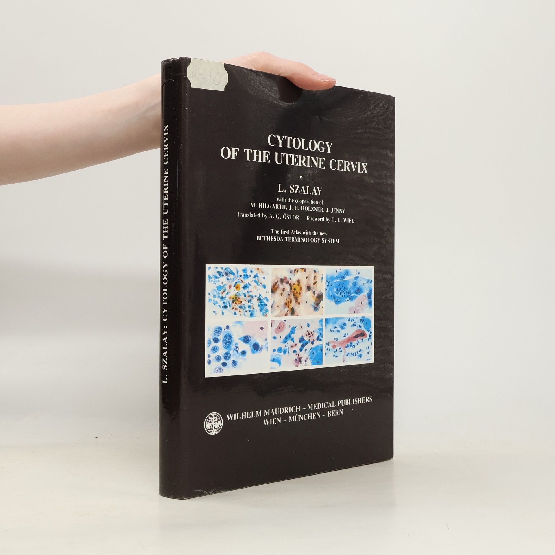 Lászlóné Szalay-Marzsó Cytology of the Uterine Cervix