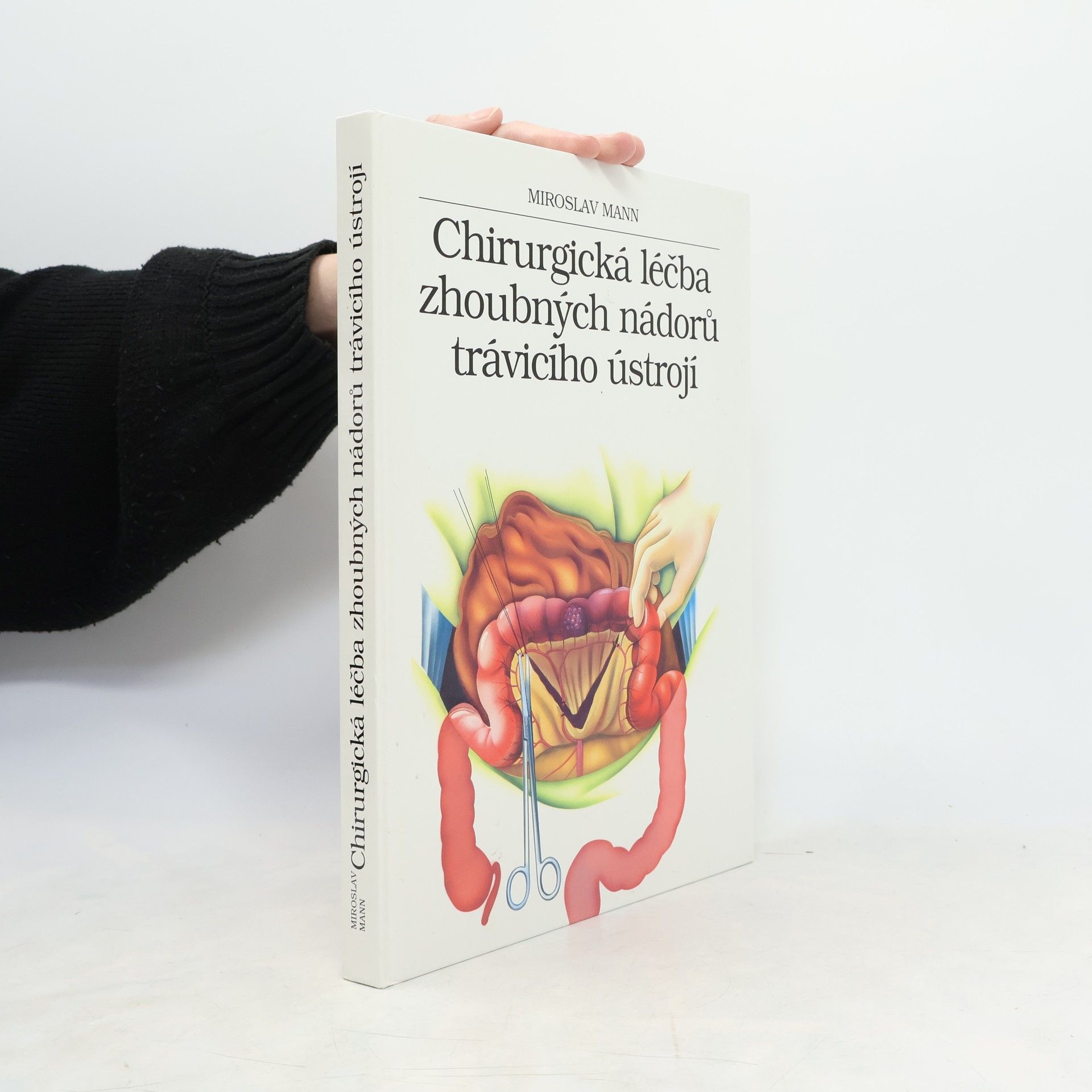 Miroslav Mann Chirurgická léčba zhoubných nádorů trávicího ústrojí