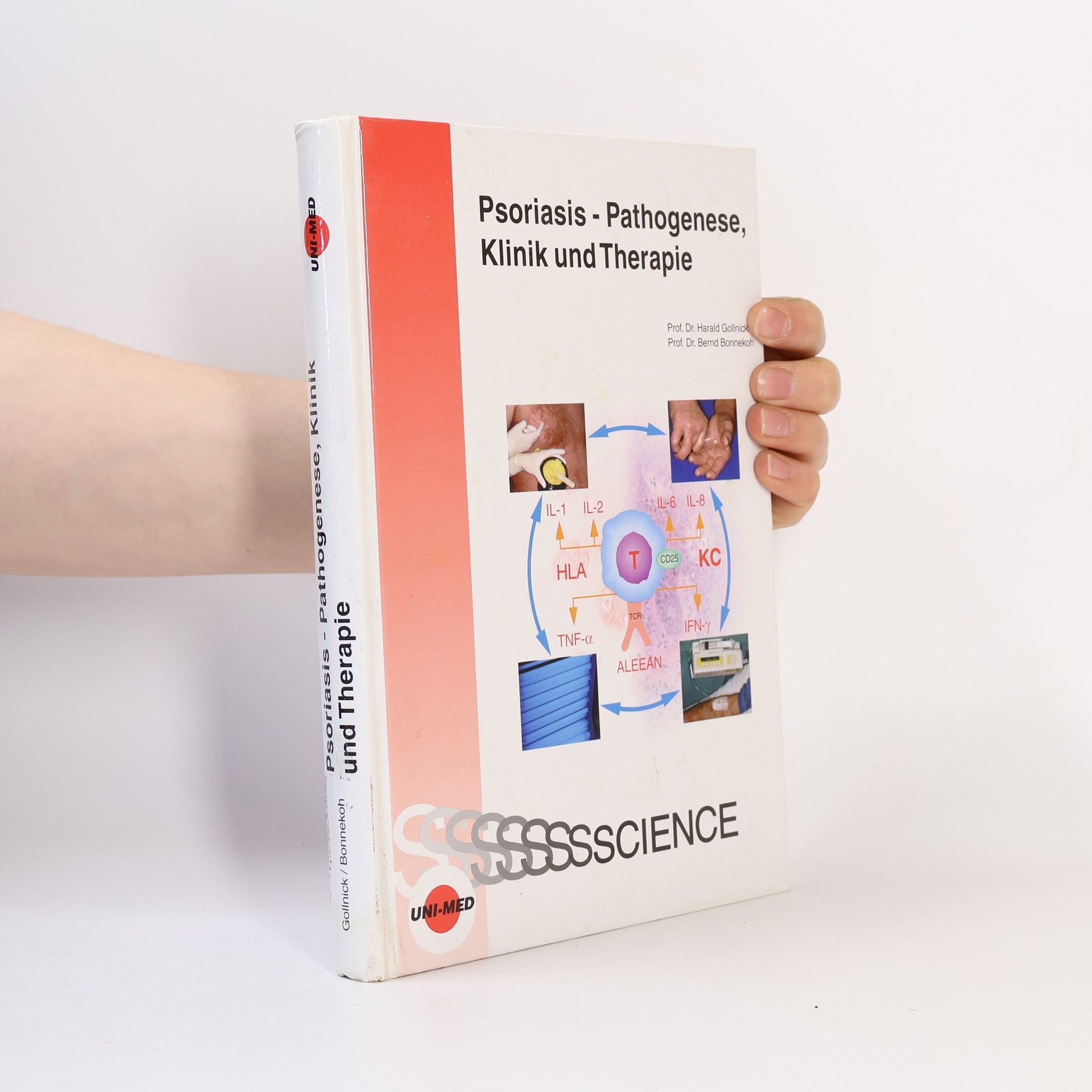 Bernd Bonnekoh Psoriasis - Pathogenese, Klinik und Therapie