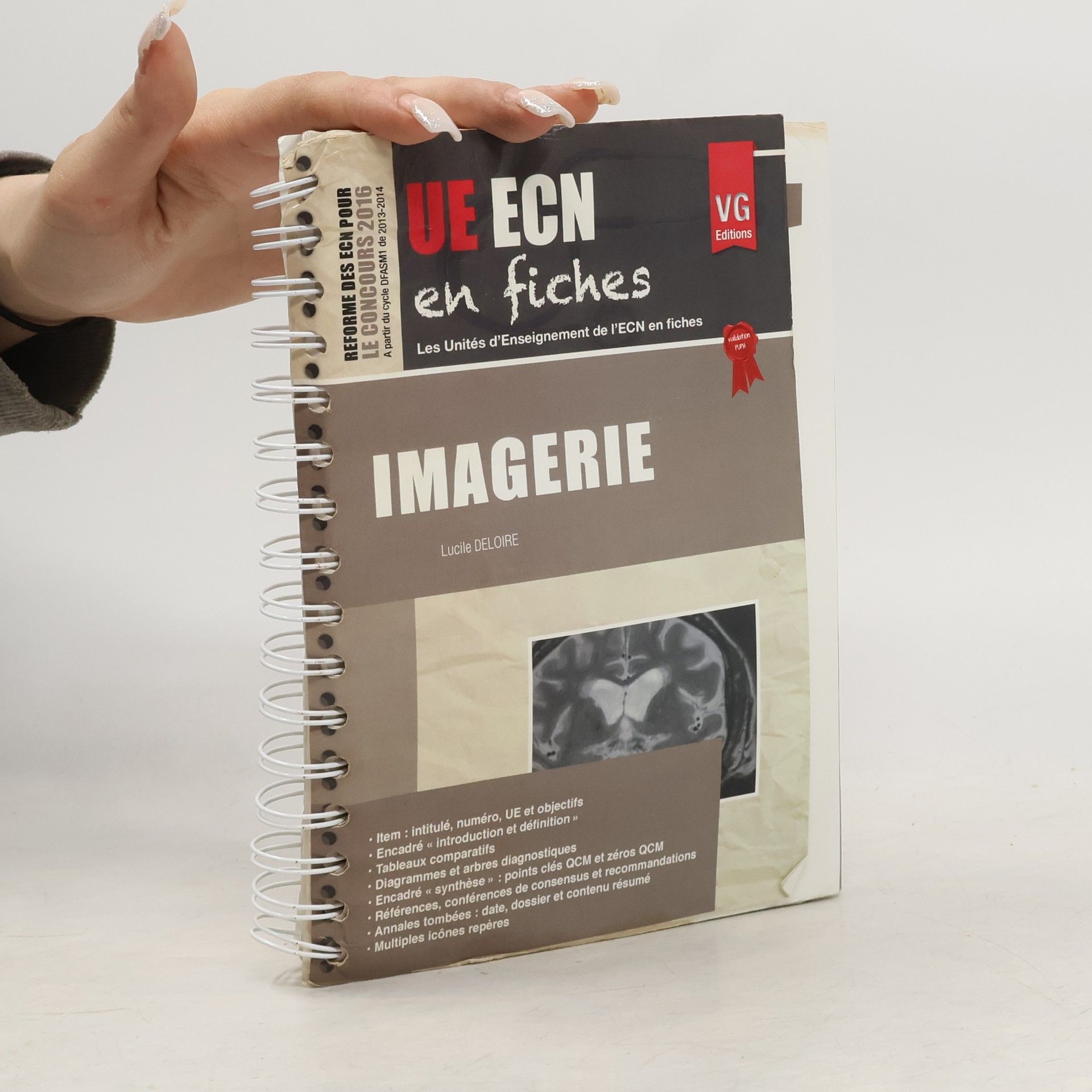 Lucile Deloire UE ECN en fiches: Imagerie
