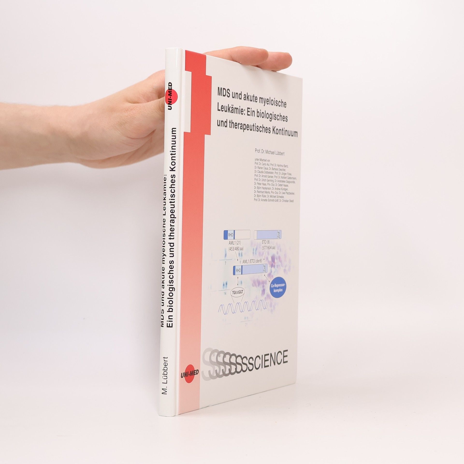 MDS und akute myeloische Leukämie