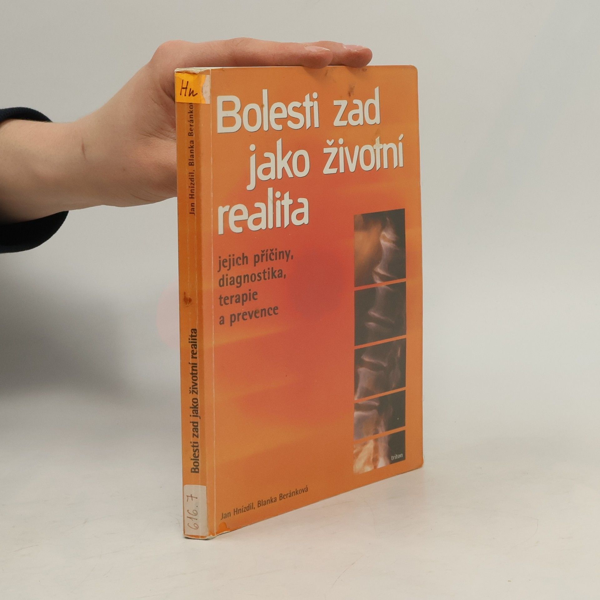 Bolesti zad jako životní realita. Jejich příčiny, diagnostika, terapie a prevence
