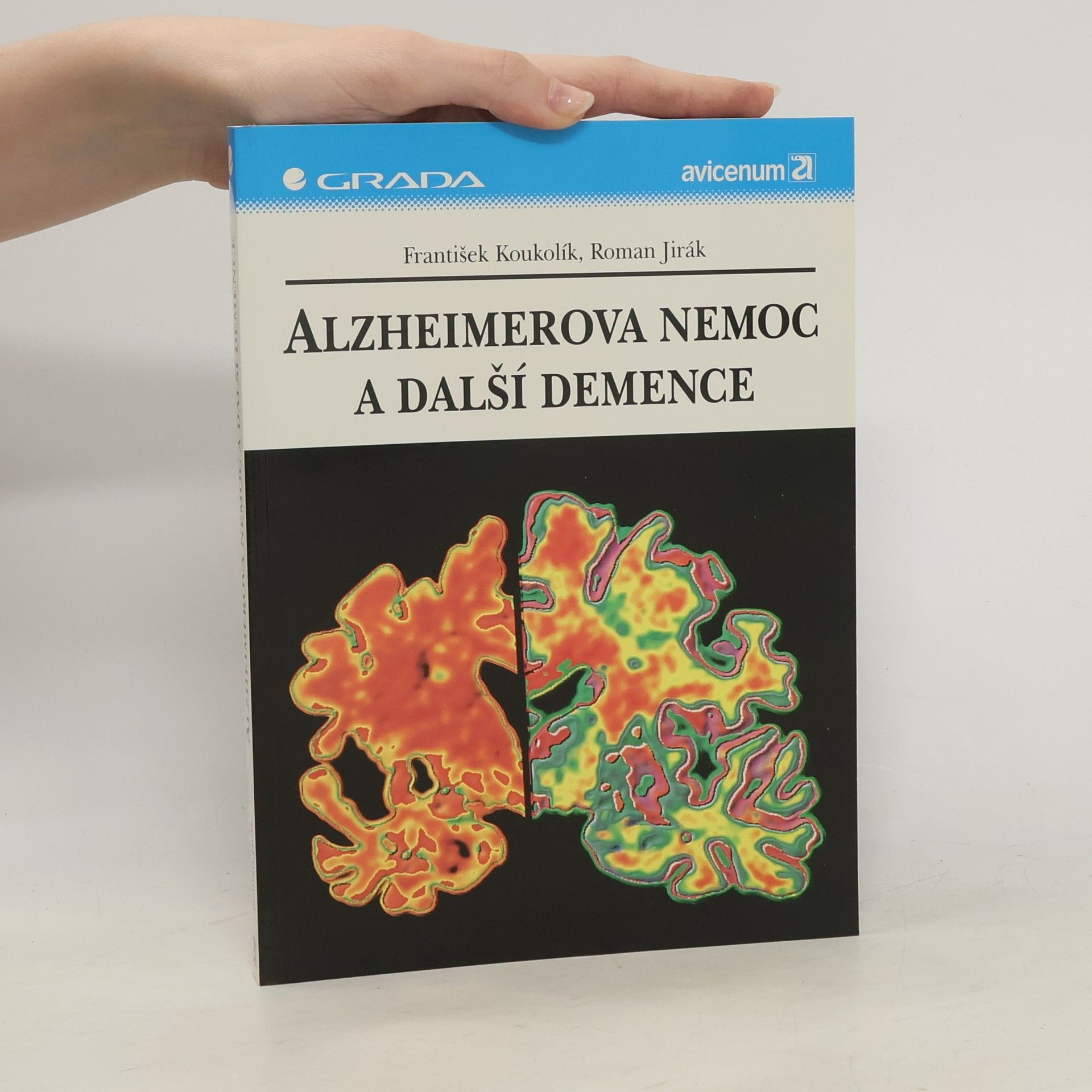 František Koukolík Alzheimerova nemoc a další demence