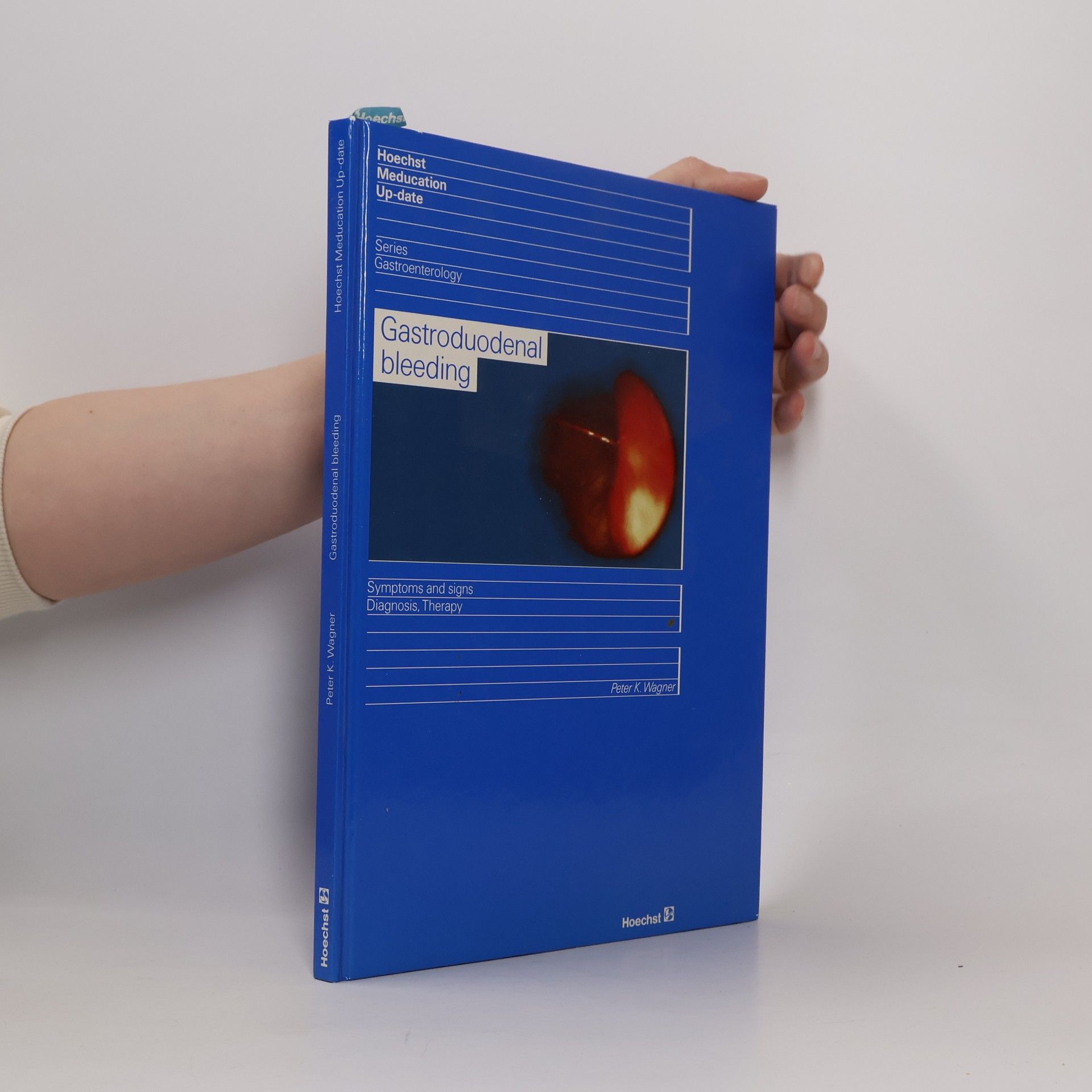 Peter K. Wagner Ulcusblutungen