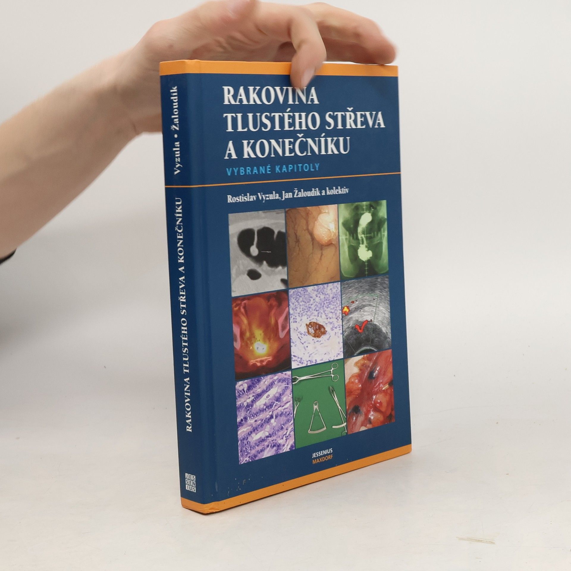 Rostislav Vyzula Rakovina tlustého střeva a konečníku : vybrané kapitoly