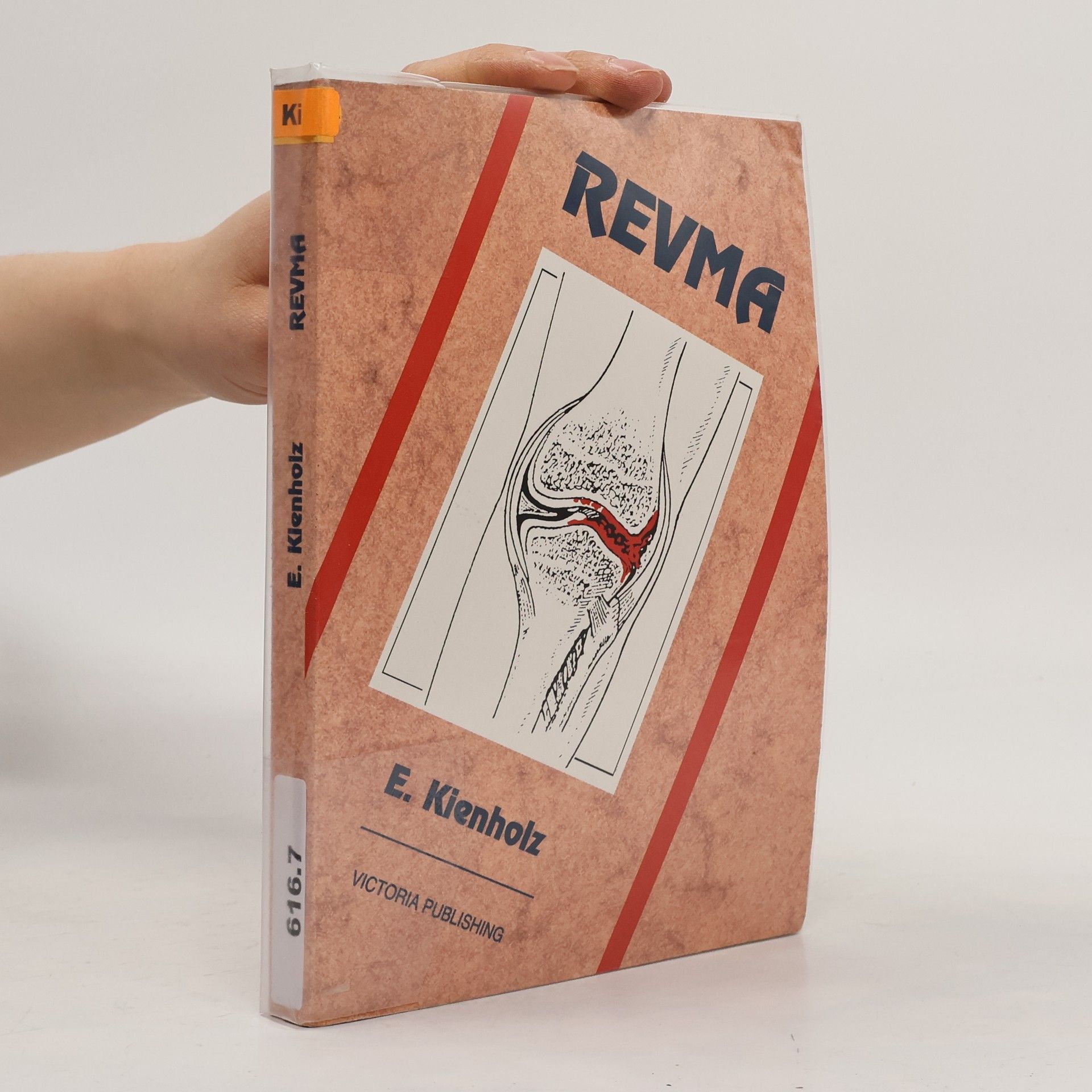Kienholz Erich Revma : odlišnosti klinického obrazu revmatického onemocnění; způsoby léčení se zvláštním zřetelem na přírodní léčebné postupy a homeopatii
