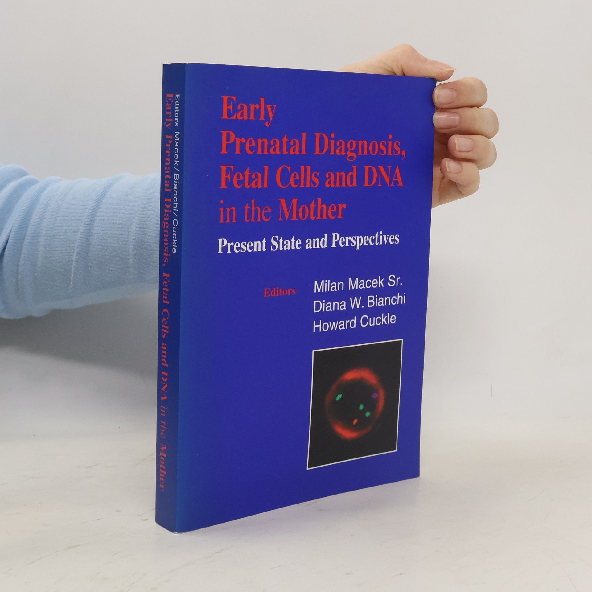 Milan Macek Sr. Early Prenatal Diagnosis, Fetal Cells And DNA In The Mother - Present State And Perspectives