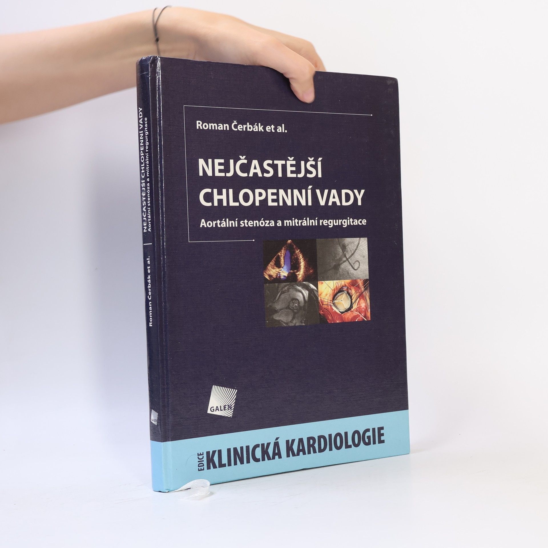 Roman Čerbák Nejčastější chlopenní vady - Aortální stenóza a mitrální regurgitace