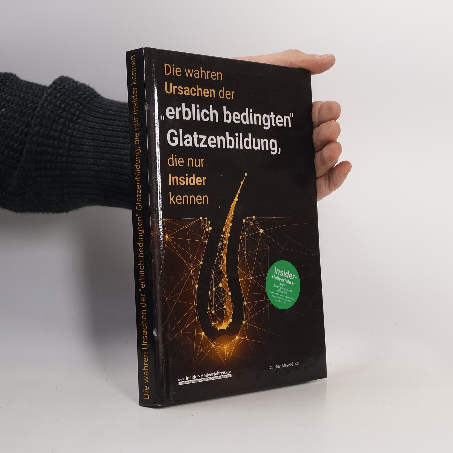 Christian Meyer-Esch Die wahren Ursachen der „erblich bedingten“ Glatzenbildung, die nur Insider kennen