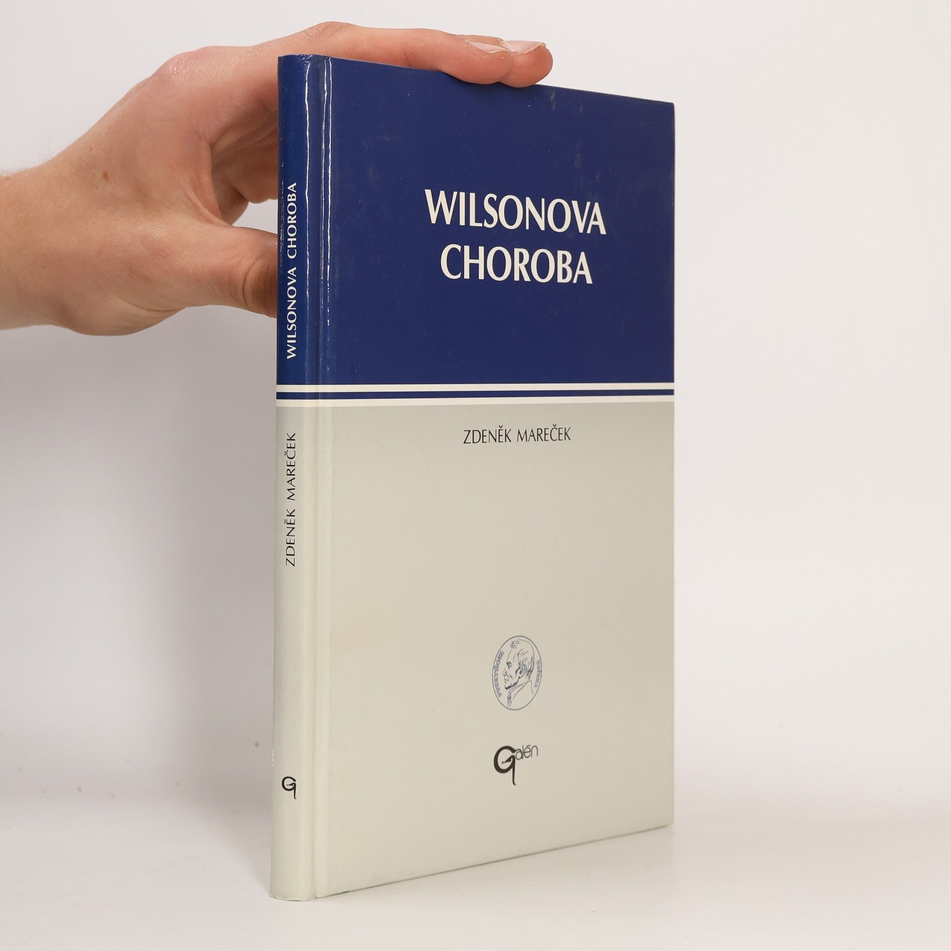 Wilsonova choroba