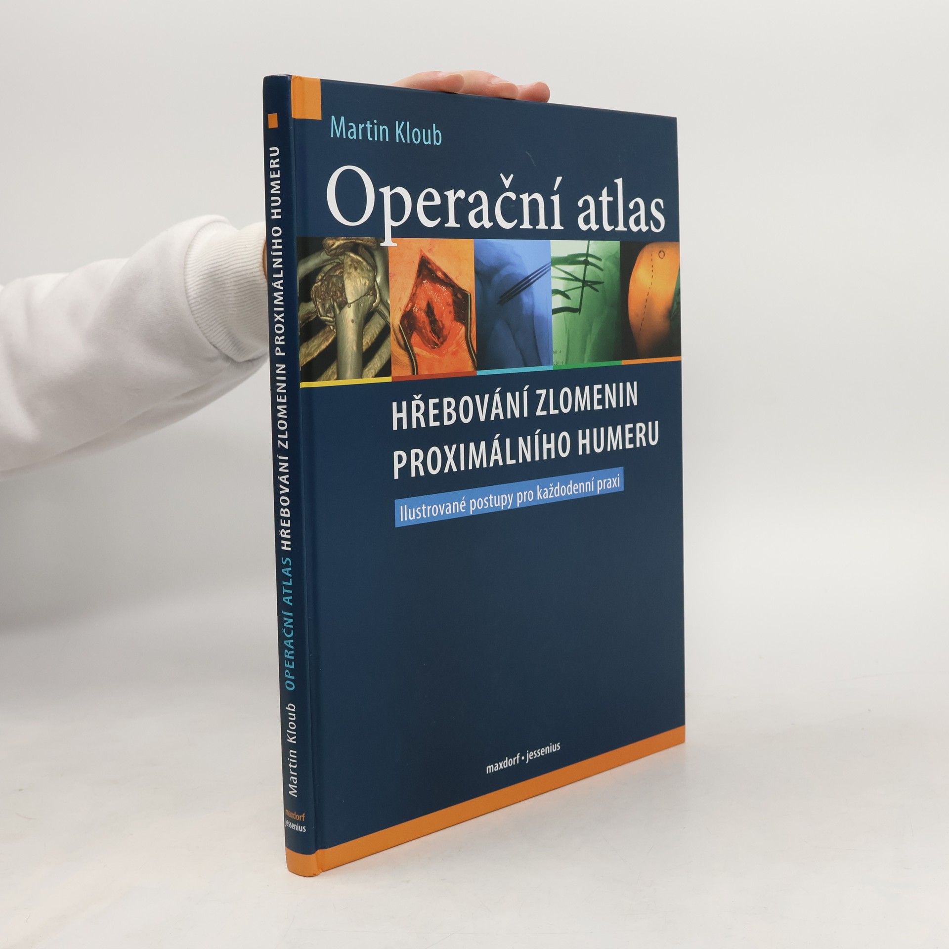 Martin Kloub Operační atlas hřebování zlomenin proximálního humeru