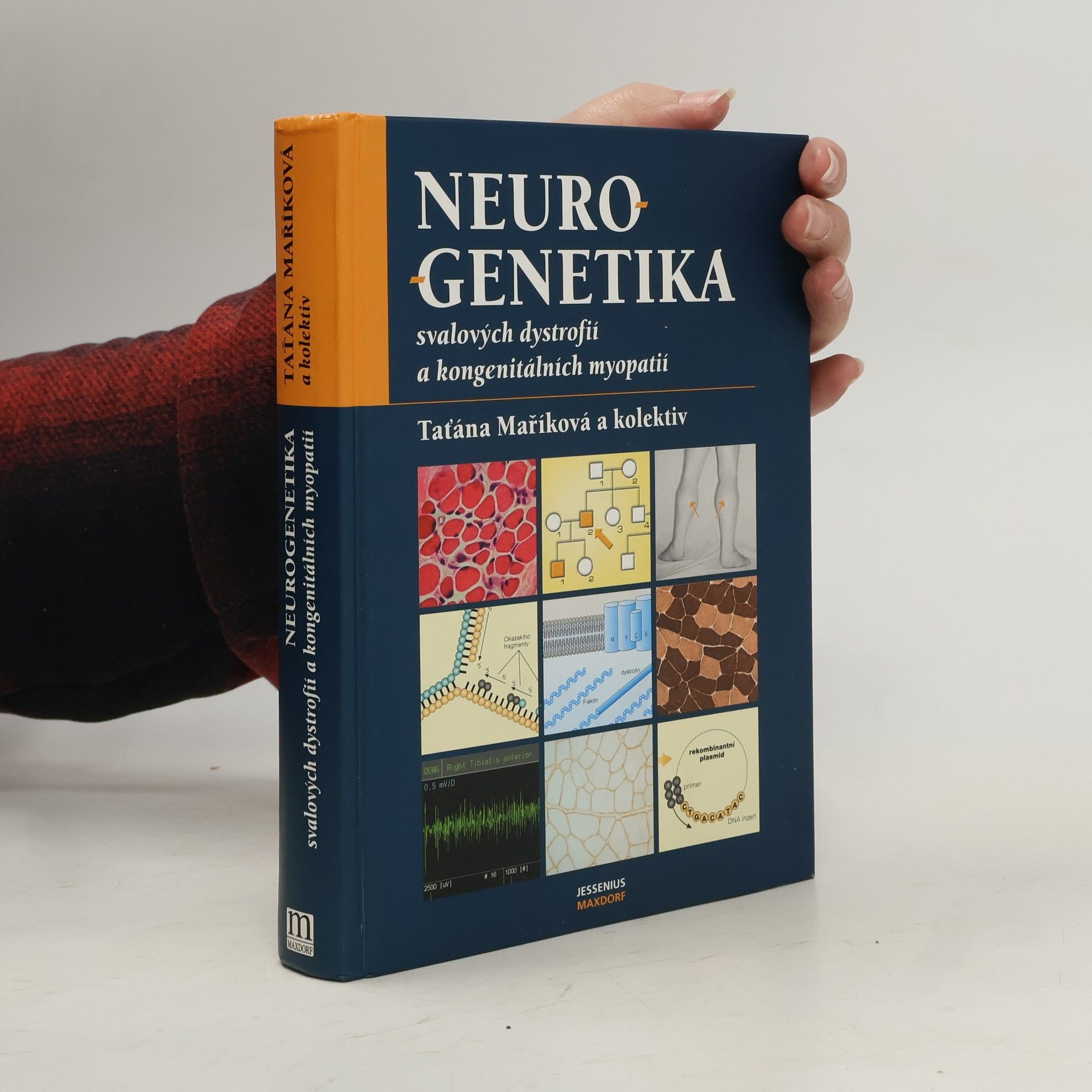 Taťána Maříková Neurogenetika svalových dystrofií a kongenitálních myopatií