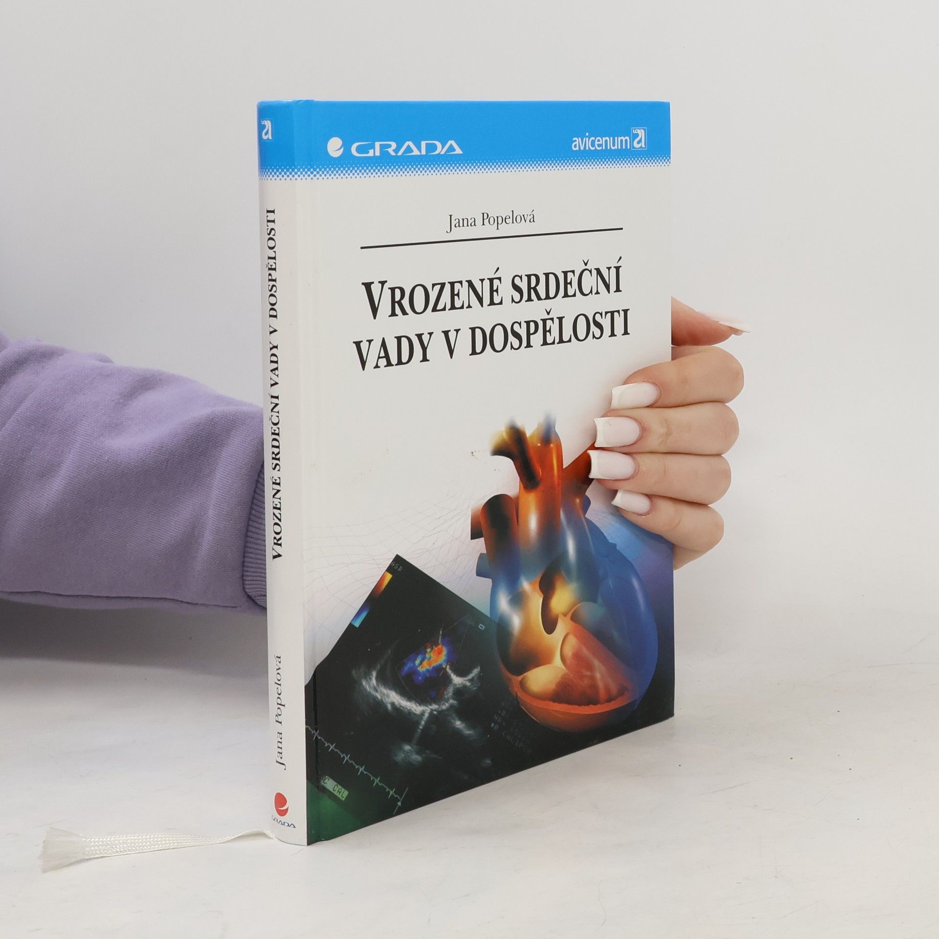 Jana Popelová Vrozené srdeční vady v dospělosti