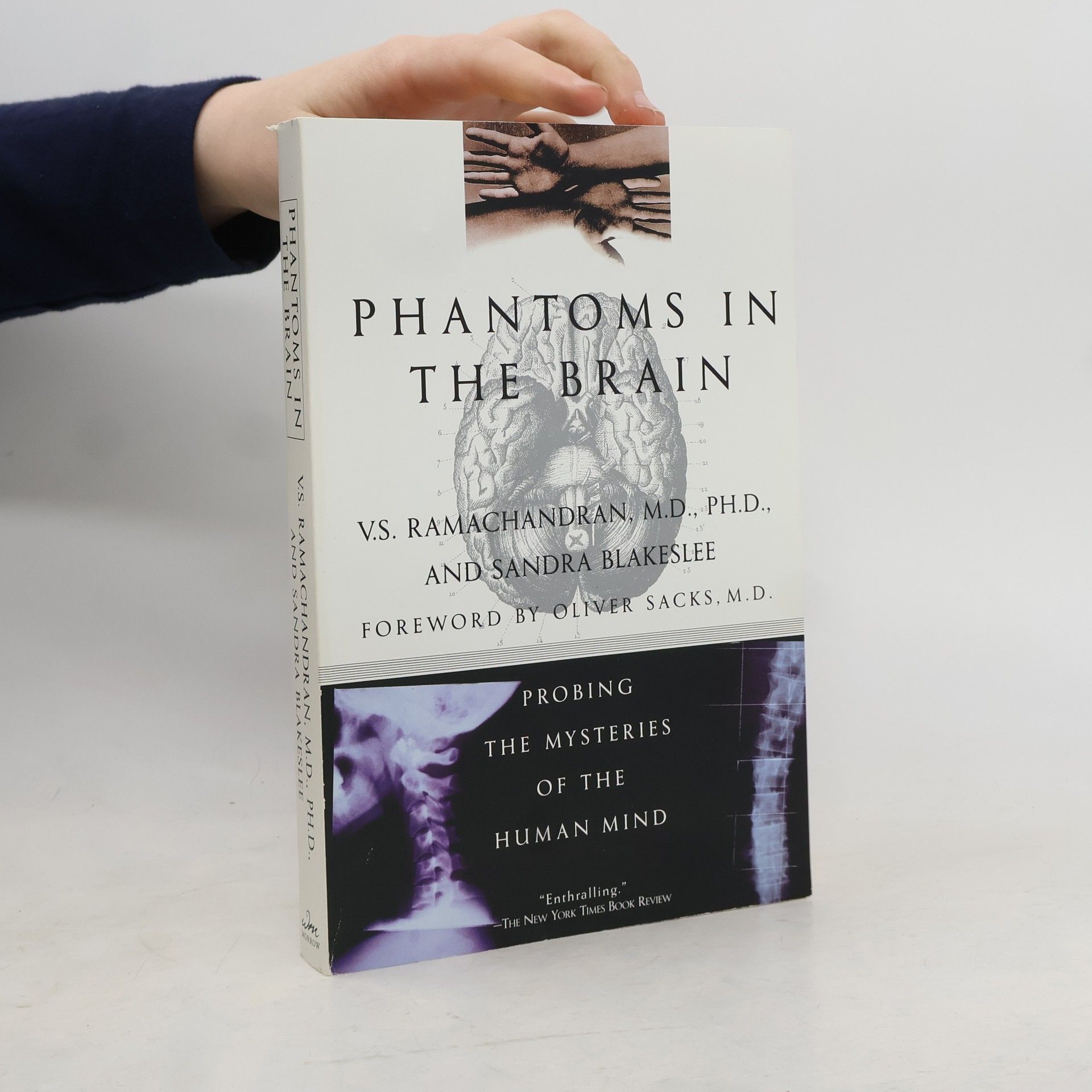 Phantoms in the Brain