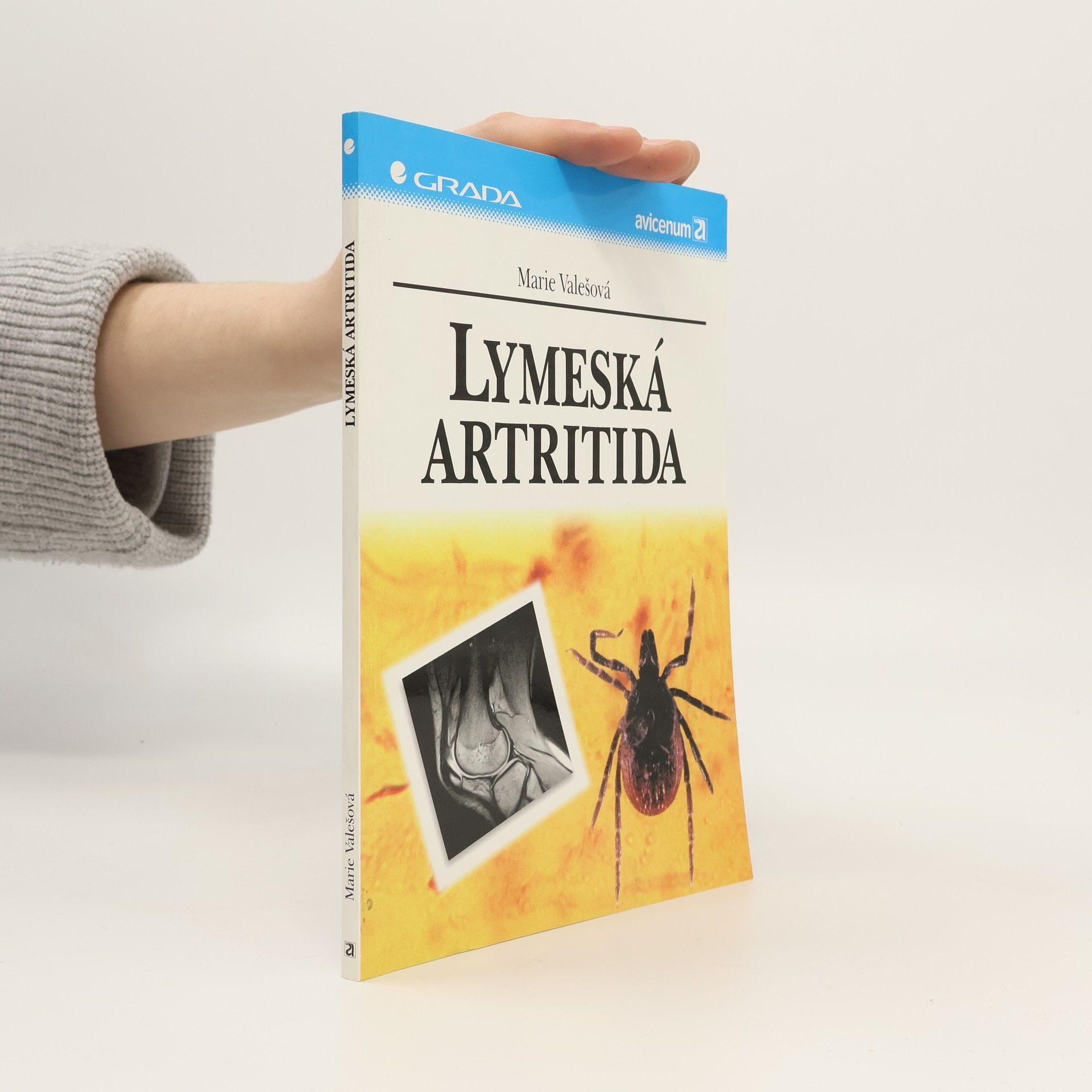 Marie Valešová Lymeská artritida