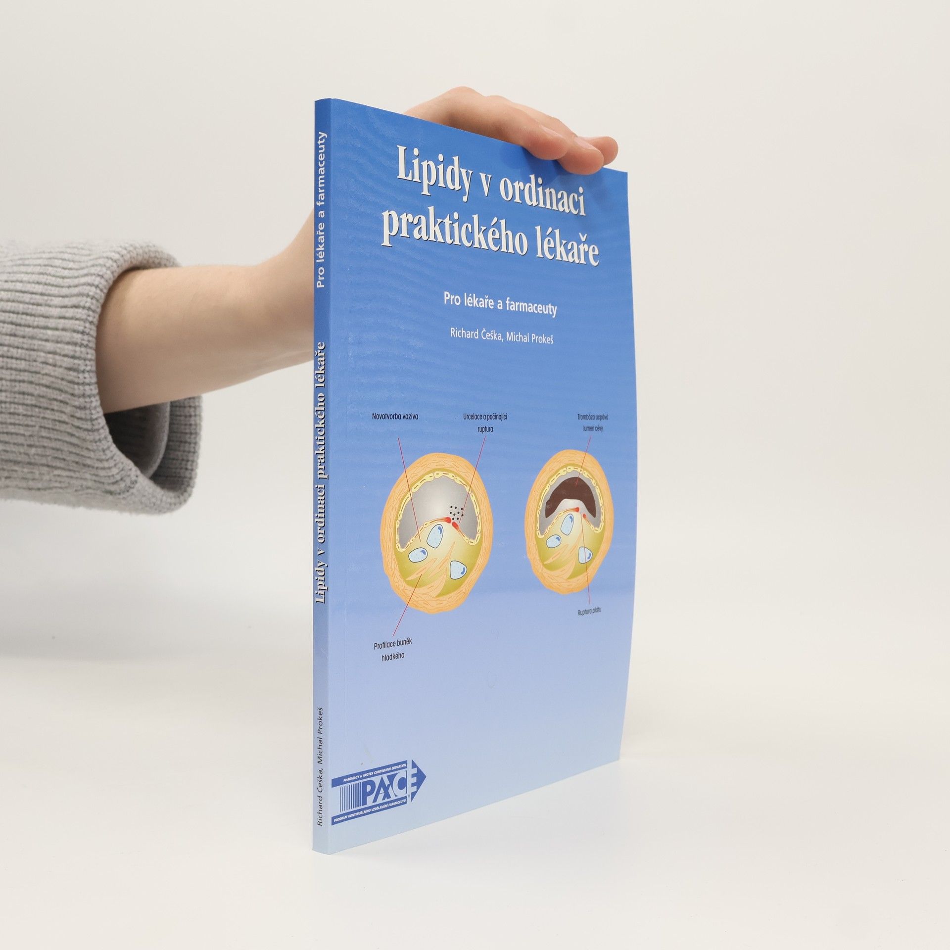 Richard Češka Lipidy v ordinaci praktického lékaře. Pro lékaře a farmaceuty