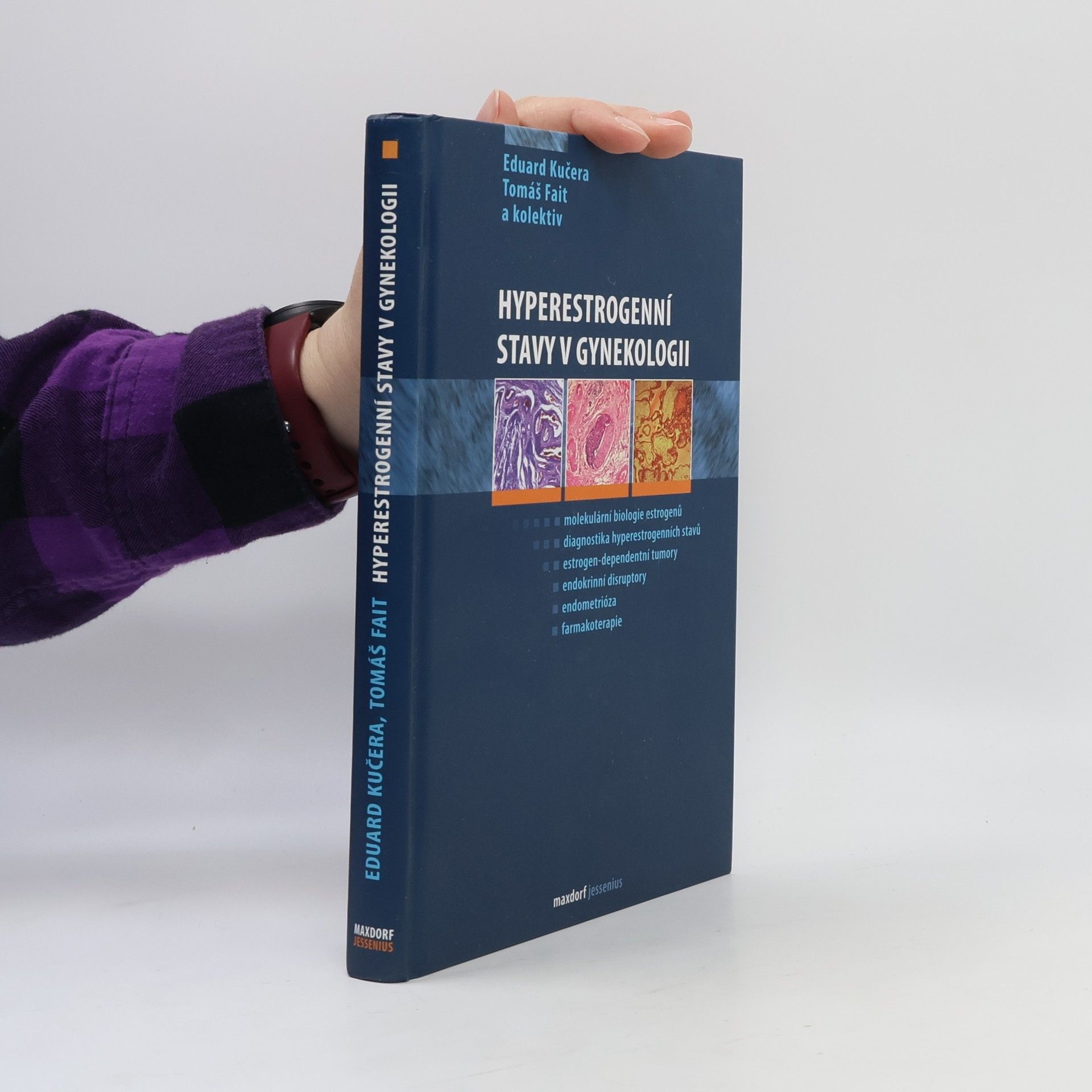 Kučera Eduard Hyperestrogenní stavy v gynekologii