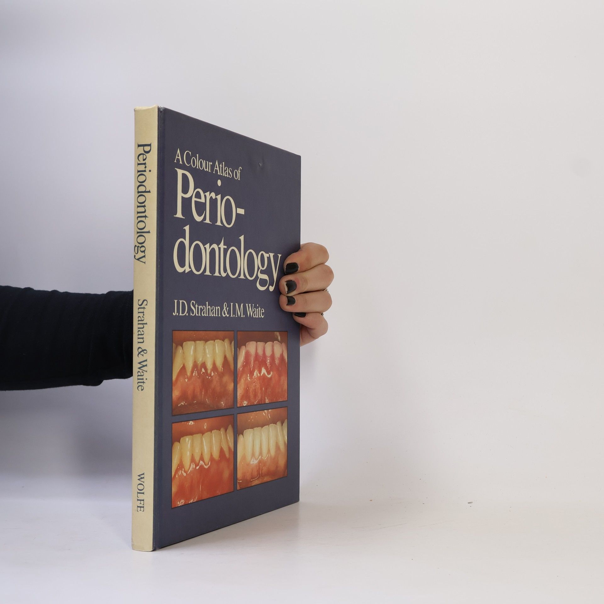 A Colour Atlas of Periodontology