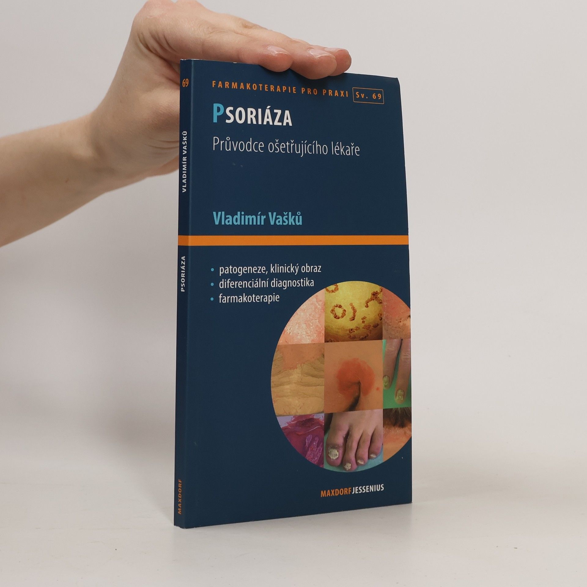 Vladimír Vašků Psoriáza