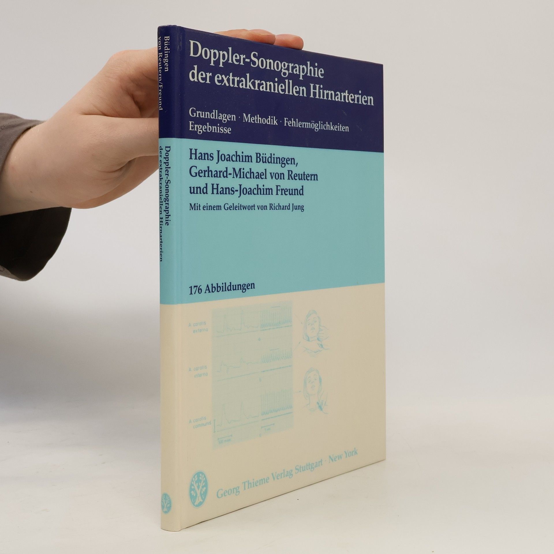 Hans Joachim Freund Doppler-Sonographie der extrakraniellen Hirnarterien