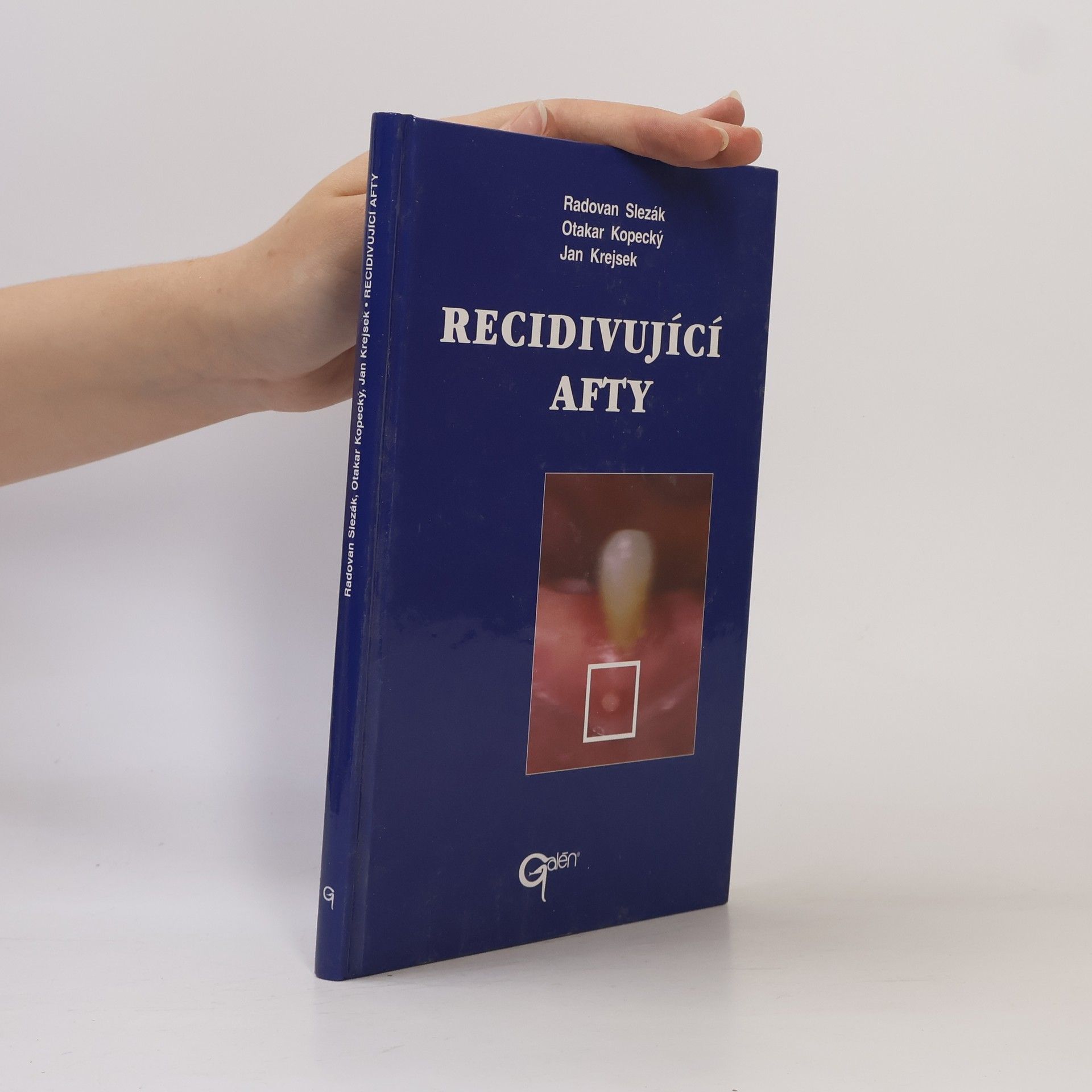 Radovan Slezák Recidivující afty