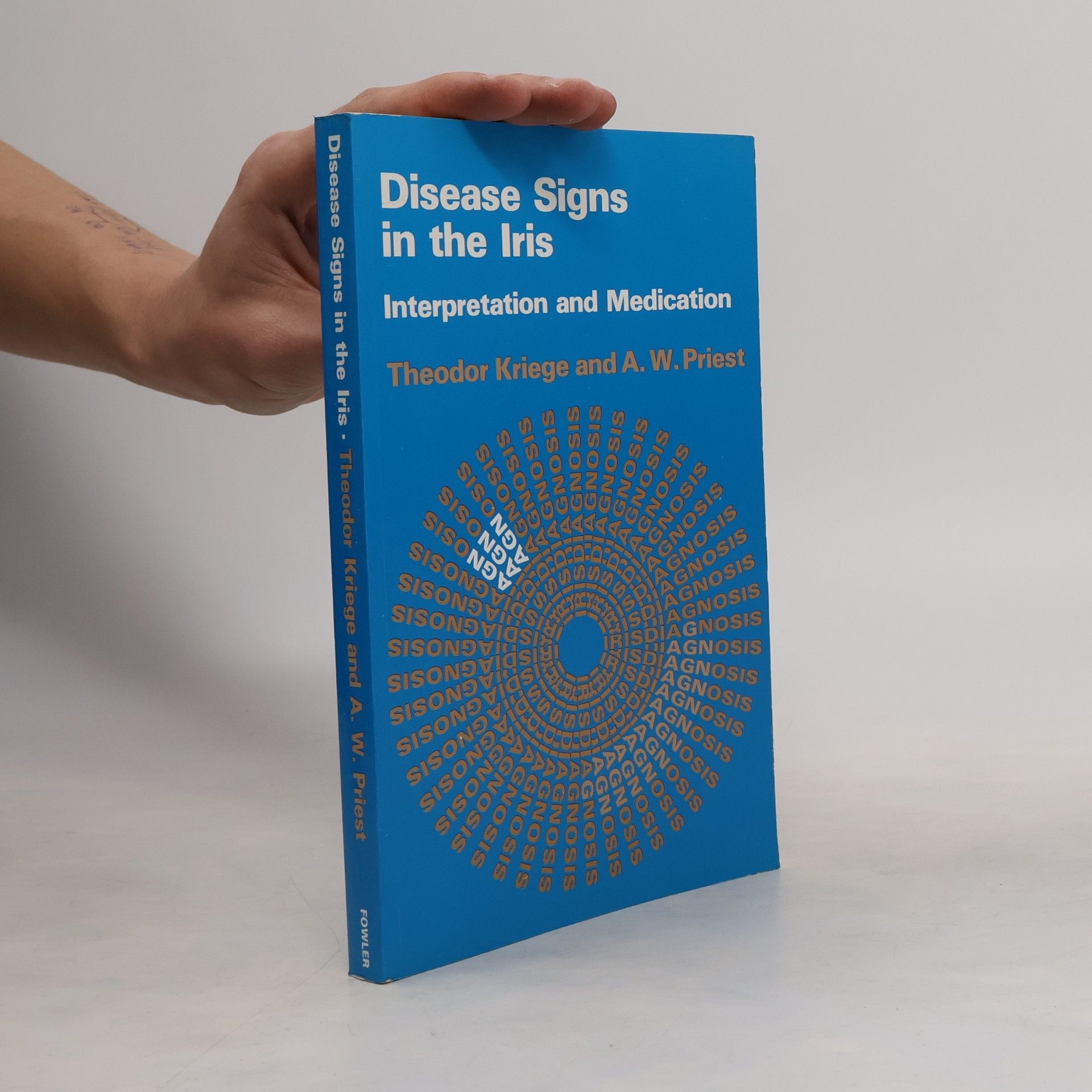 A. W. Priest Disease Signs in the Iris