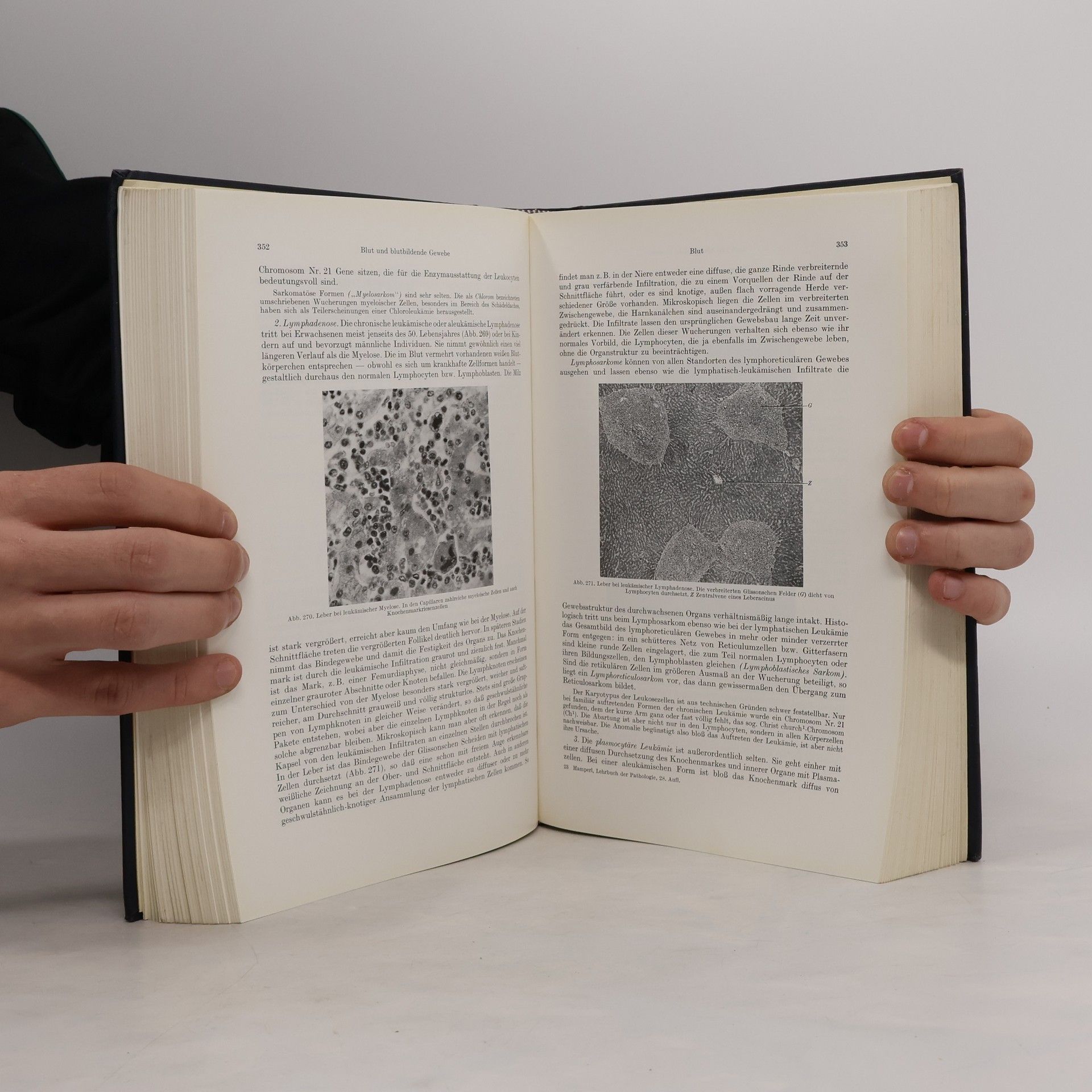 Hugo Ribbert Lehrbuch der allgemeinen Pathologie und der pathologischen Anatomie