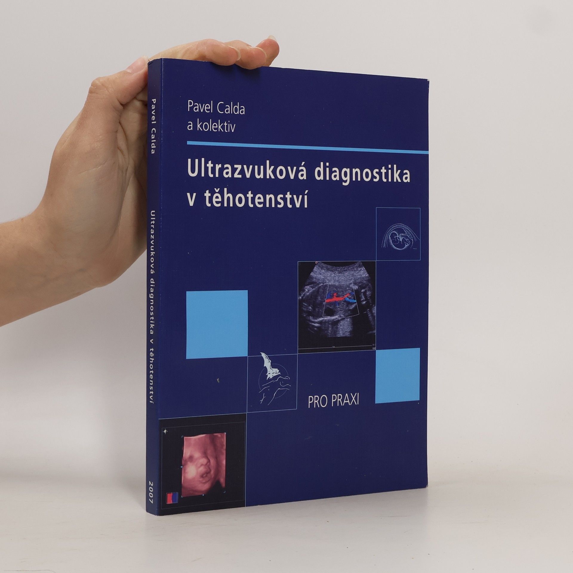 Pavel Calda Ultrazvuková diagnostika v těhotenství