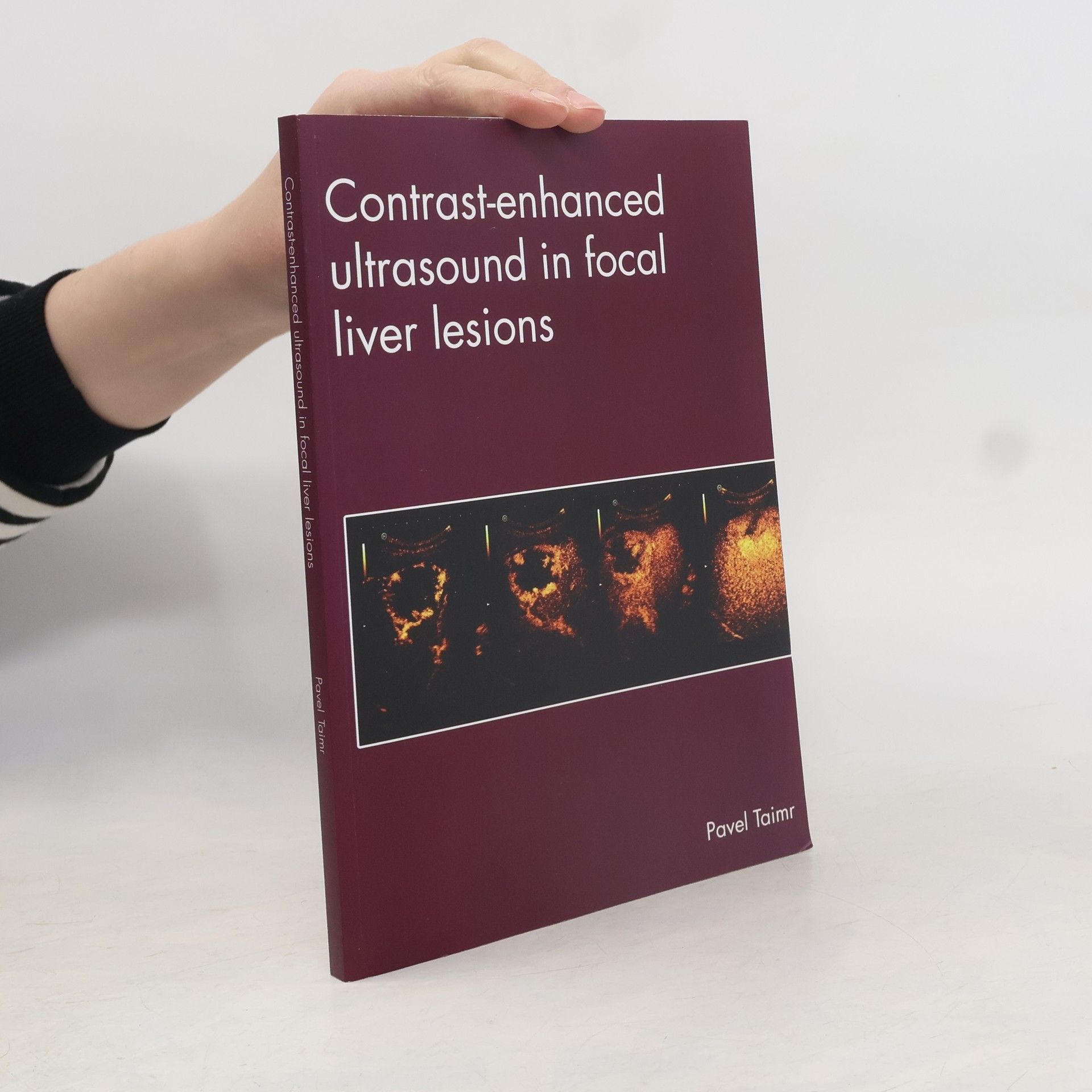 Pavel Taimr Contrast-enhanced ultrasound in focal liver lesions