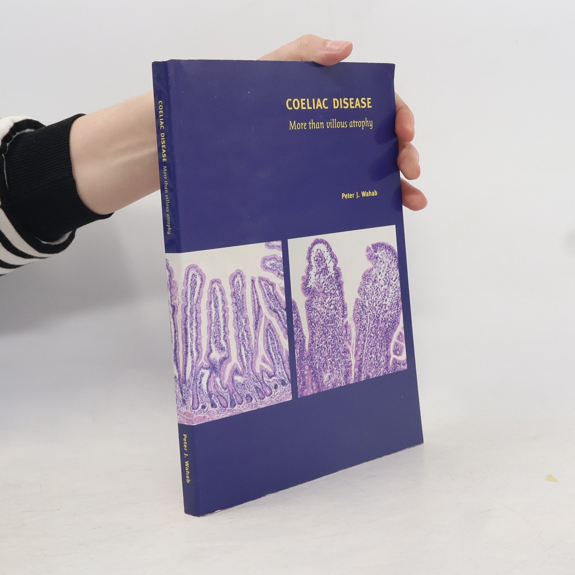 Peter J. Wahab Coeliac Disease