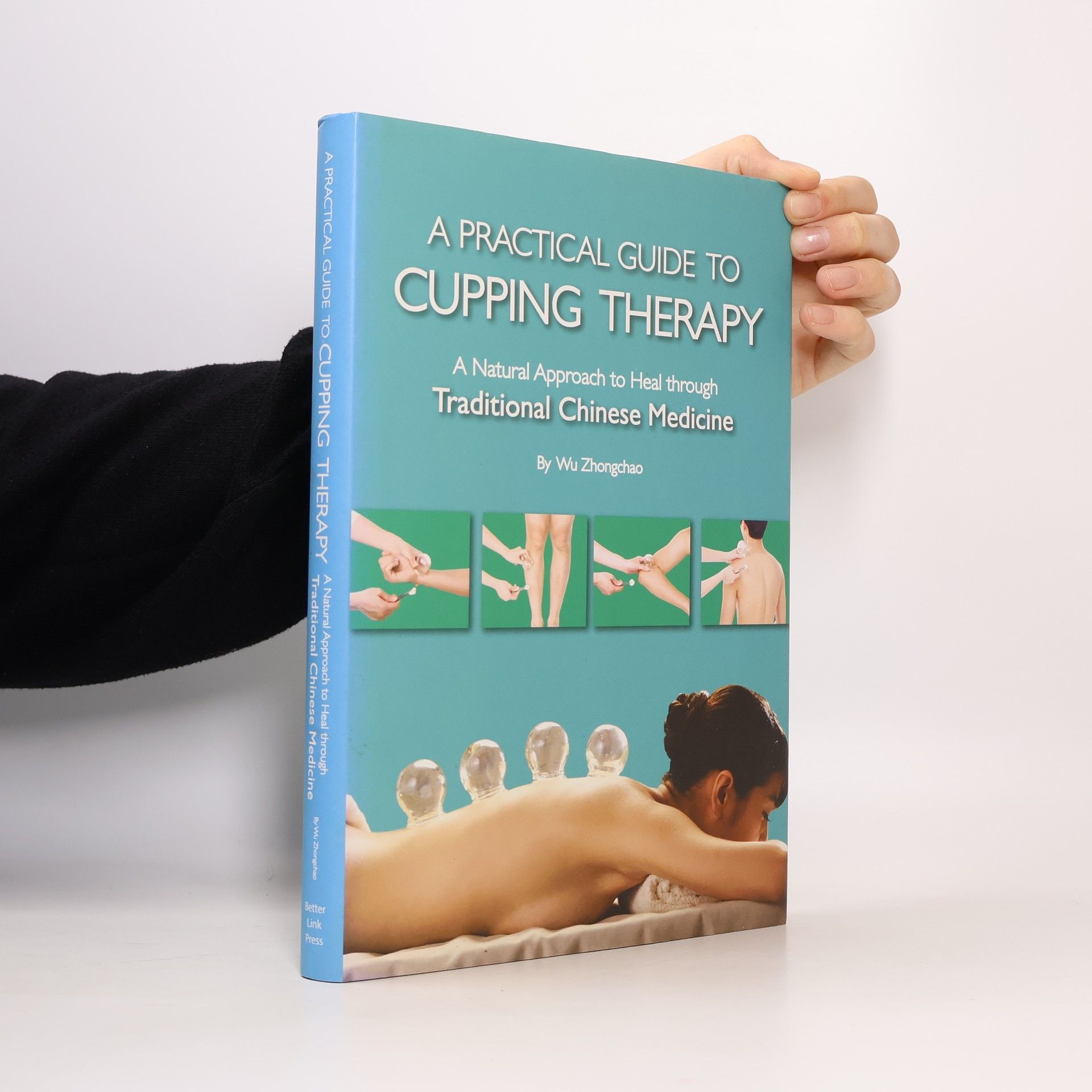 Zhongchao Wu Practical Guide to Cupping Therapy