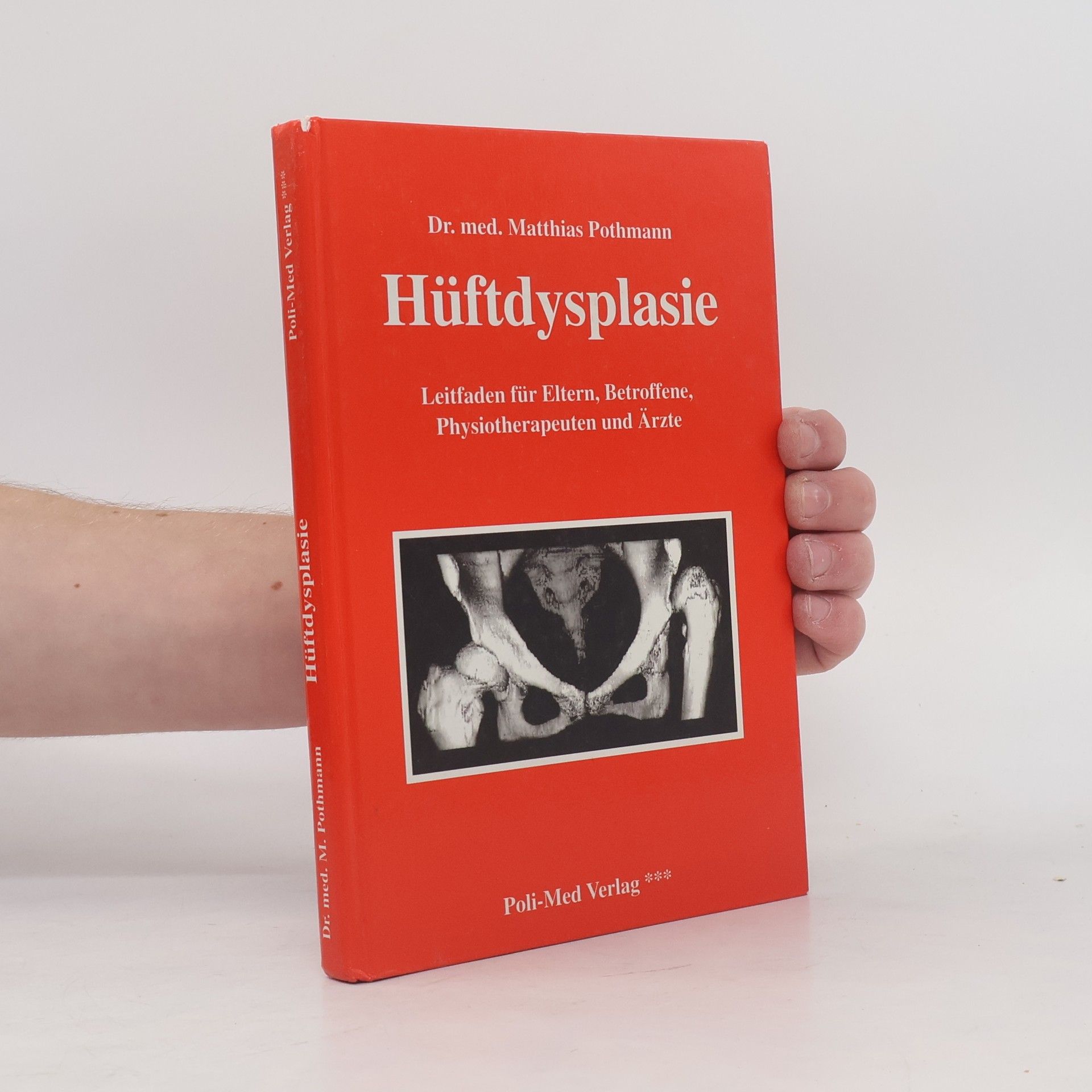 Dr. med. Matthias Pothmann Hüftdysplasie