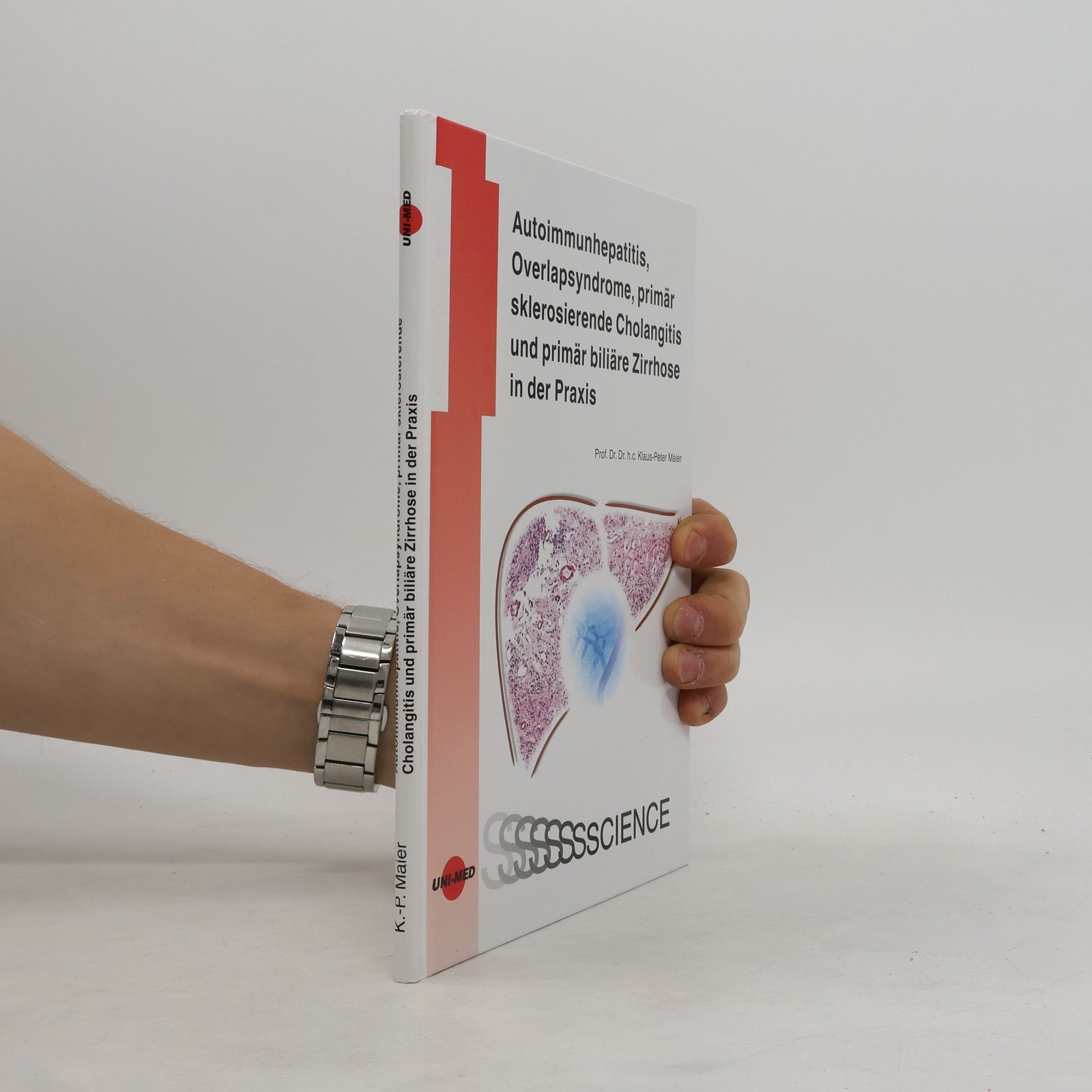 Klaus-Peter Maier Autoimmunhepatitis, Overlapsyndrome, primär sklerosierende Cholangitis und primär biliäre Zirrhose in der Praxis