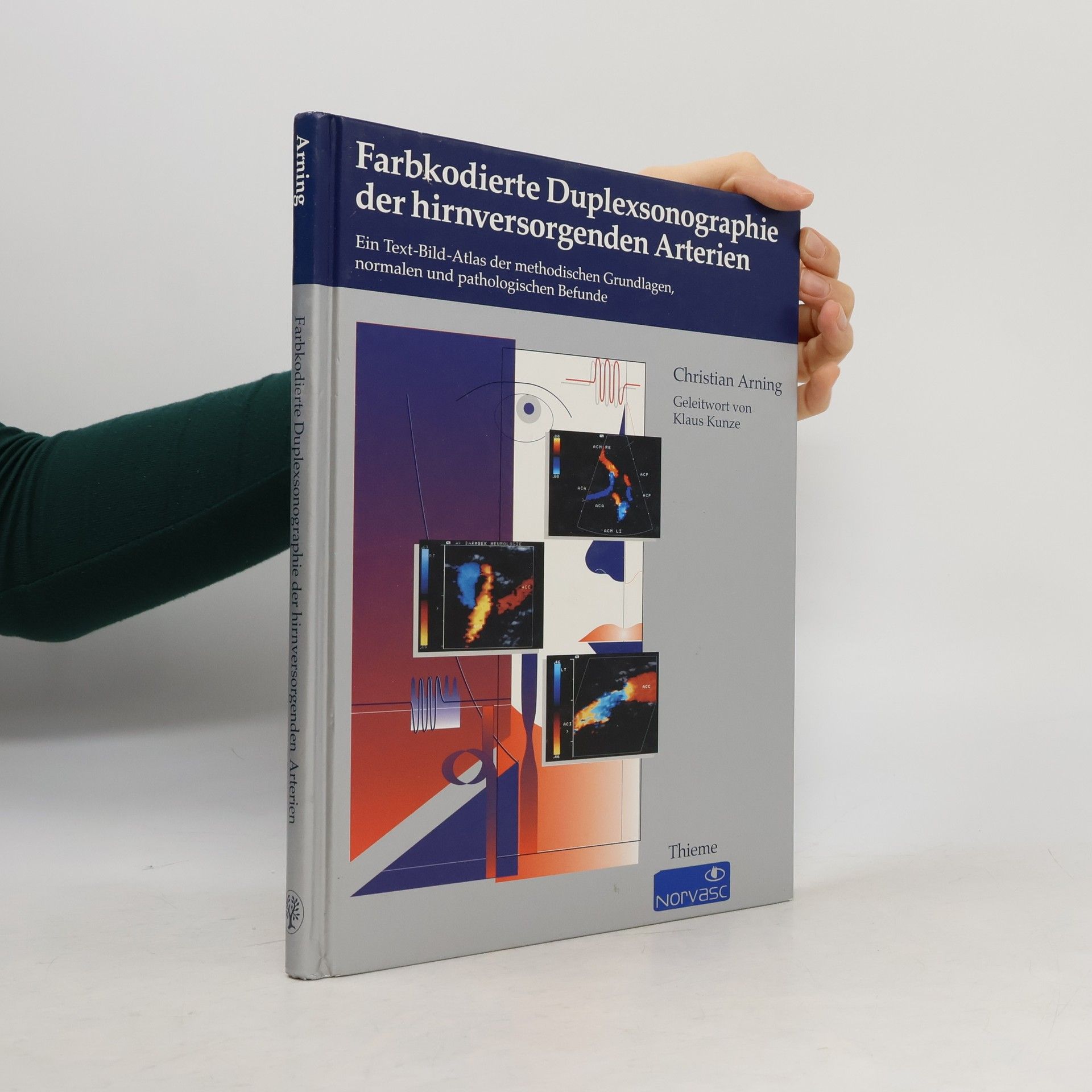 Christian Arning Farbkodierte Duplexsonographie der hirnversorgenden Arterien