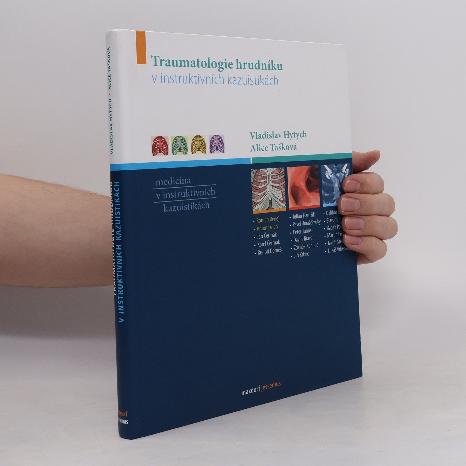 Vladislav Hytych Traumatologie hrudníku v instruktivních kazuistikách