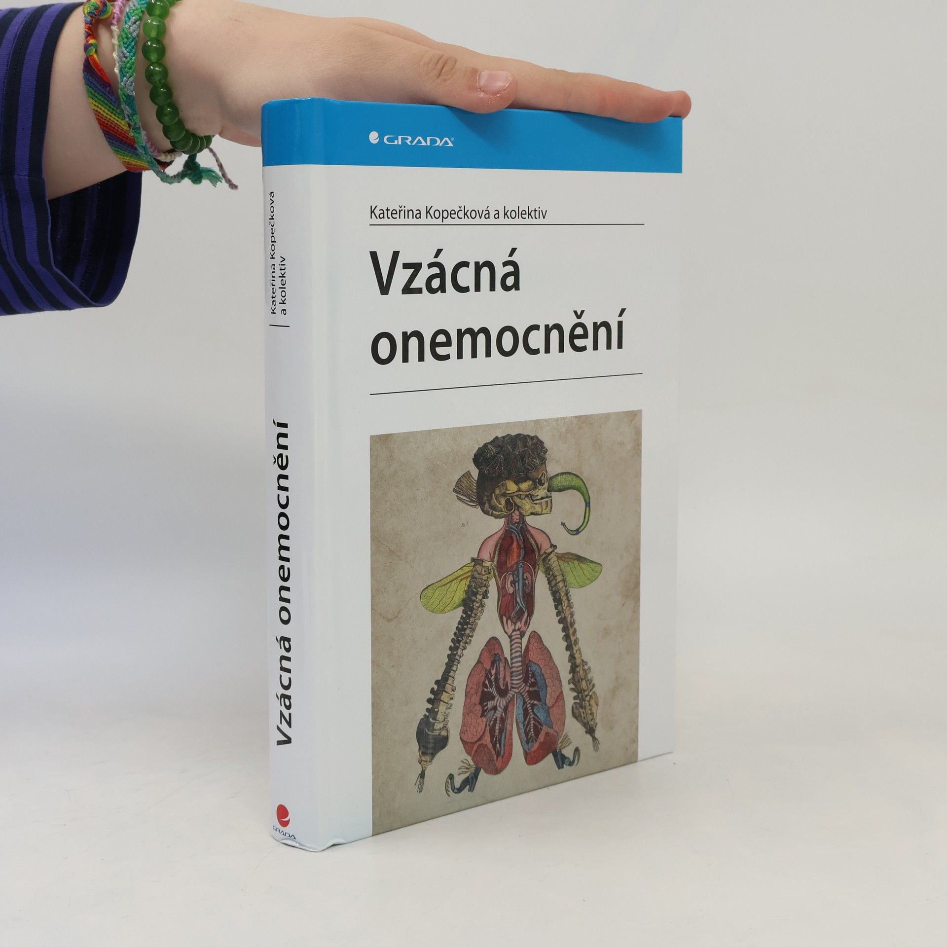 Kateřina Kopečková Vzácná onemocnění