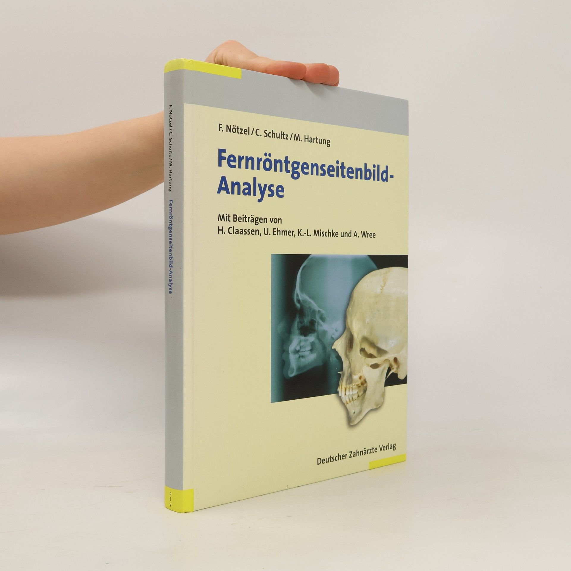 Fernröntgenseitenbild-Analyse