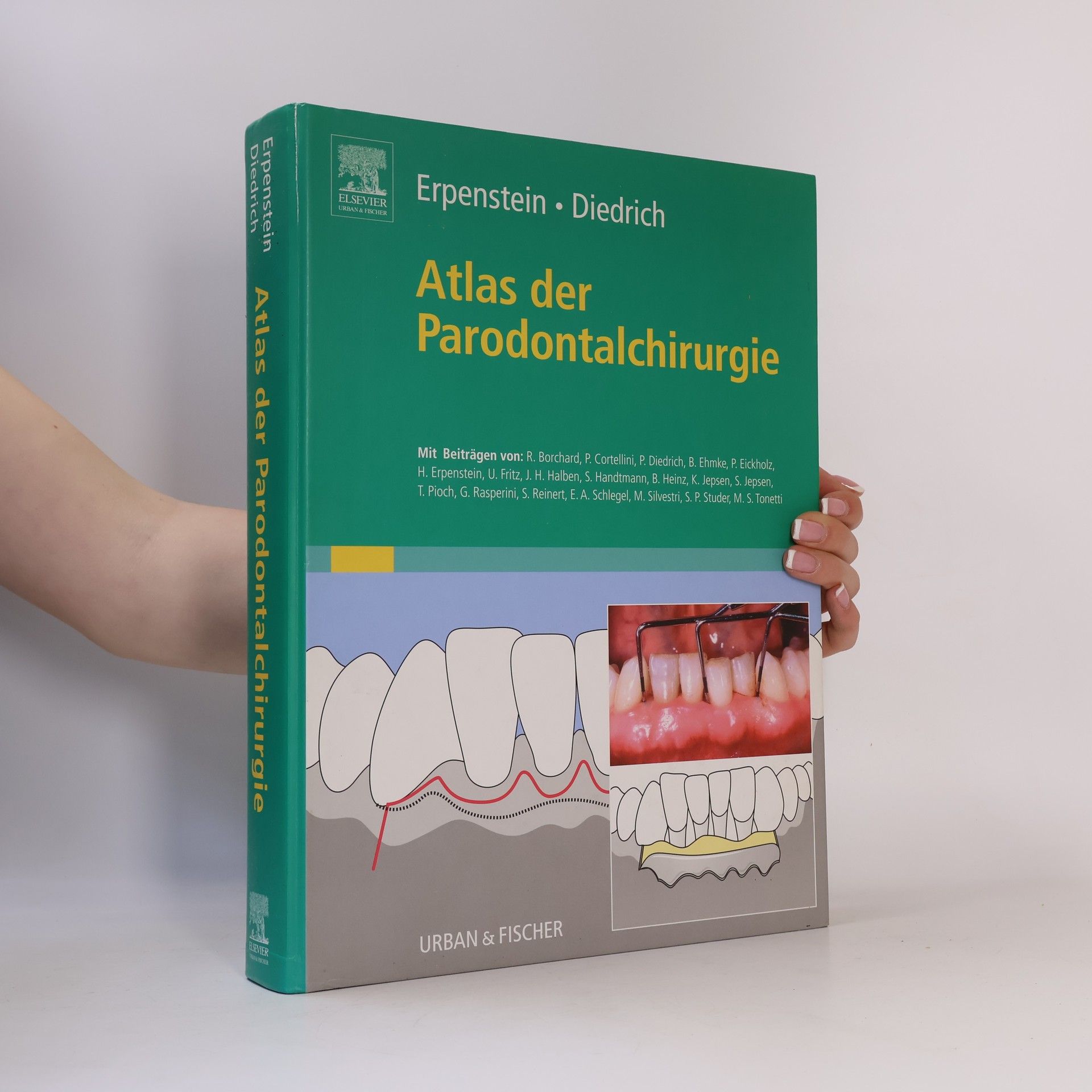 S. Jepsen Atlas der Parodontalchirurgie