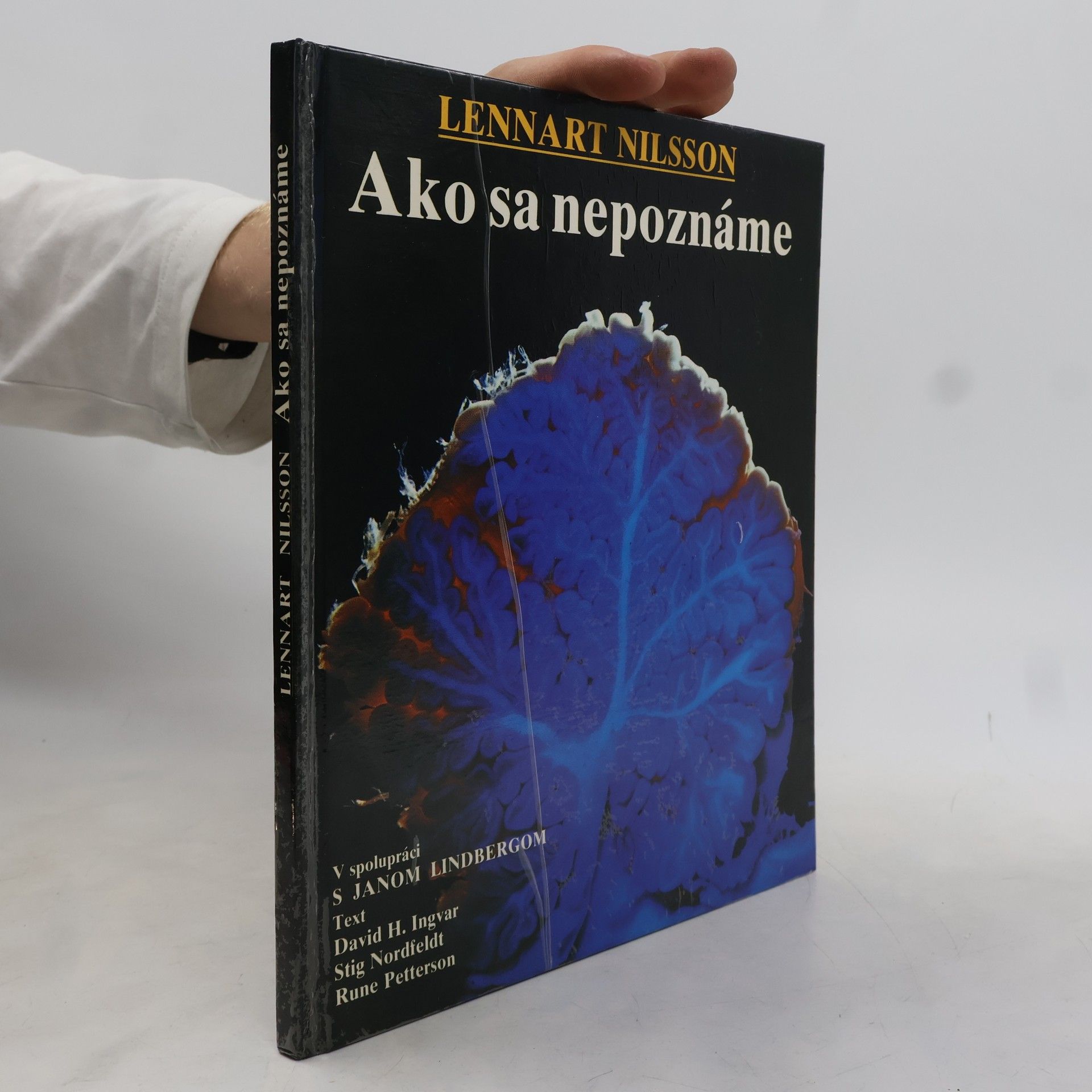 Collectif d'auteurs Ako sa nepoznáme: Objavná cesta s fotografickým aparátom do nášho tela