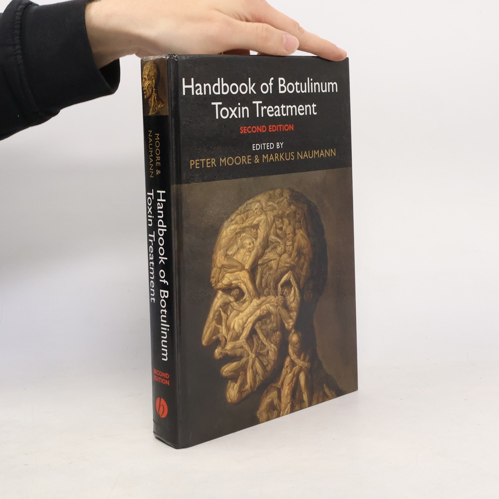 Handbook of Botulinum Toxin Treatment