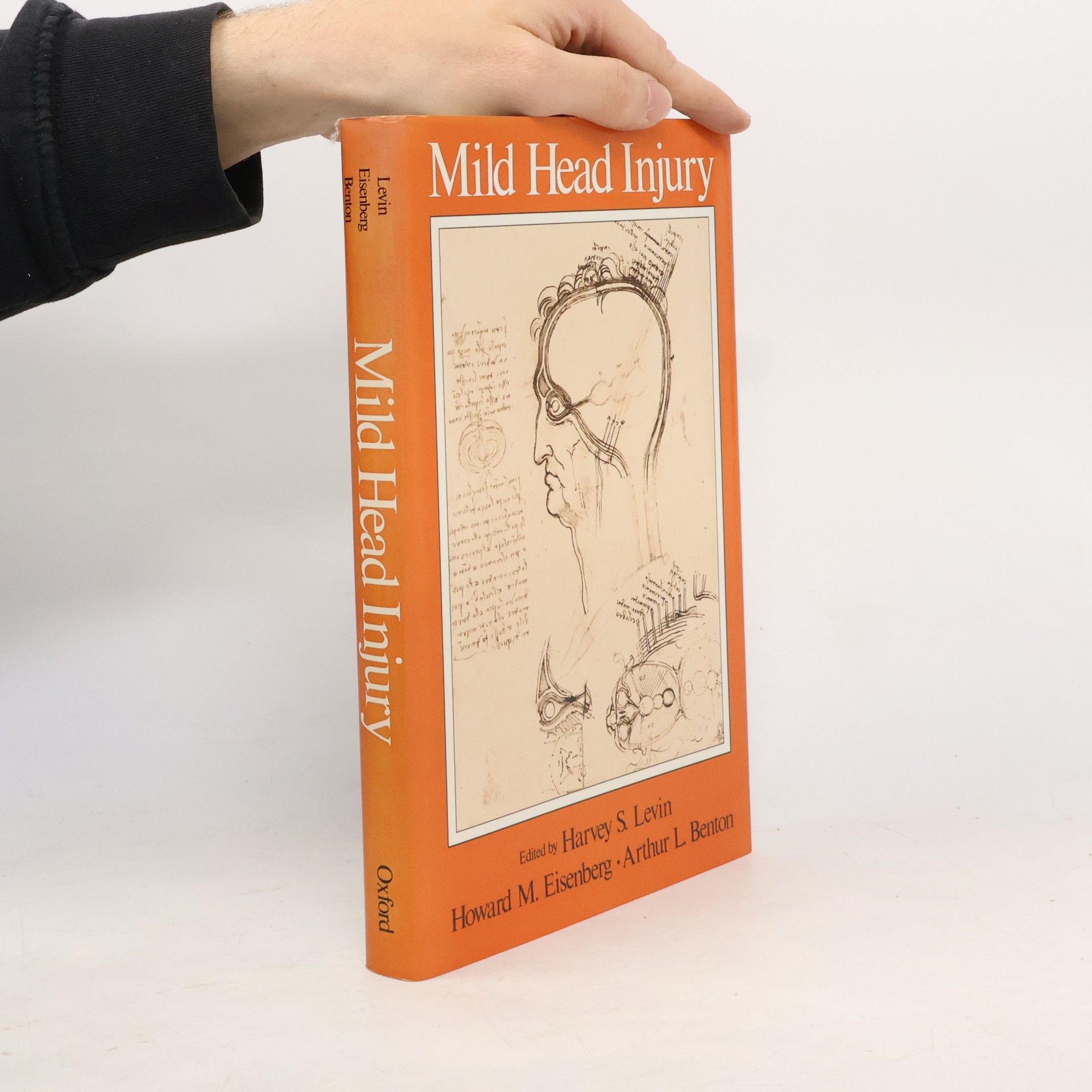 Howard M. Eisenberg Mild Head Injury