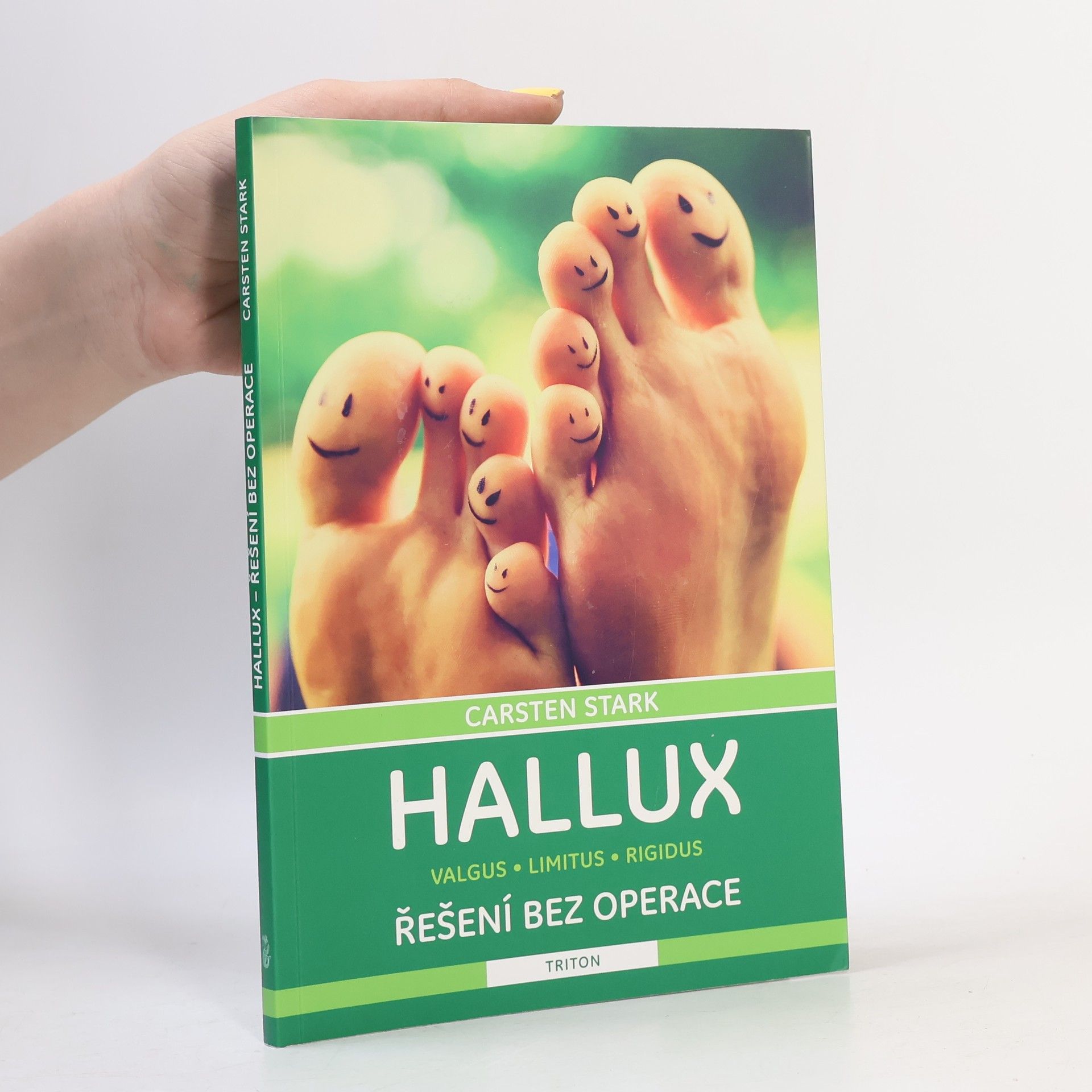 Hallux – řešení bez operace