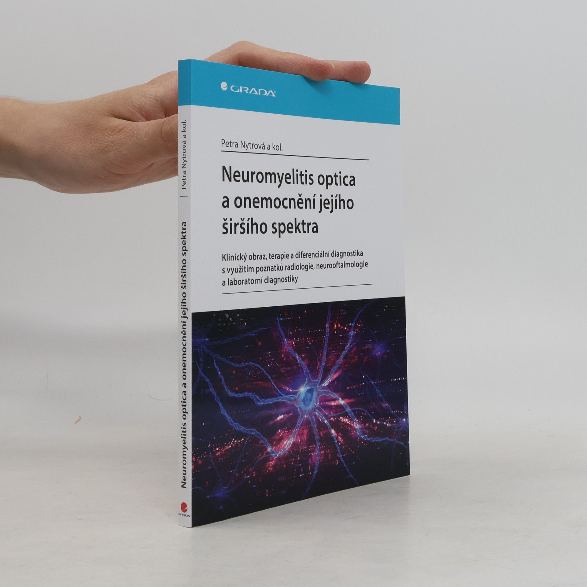 Petra Nytrová Neuromyelitis optica a poruchy jejího širšího spektra