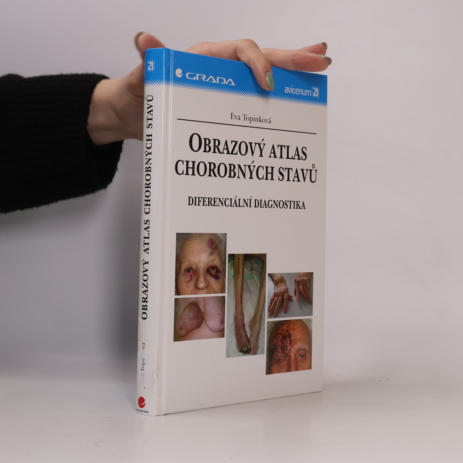 Eva Topinková Obrazový atlas chorobných stavů : diferenciální diagnostika